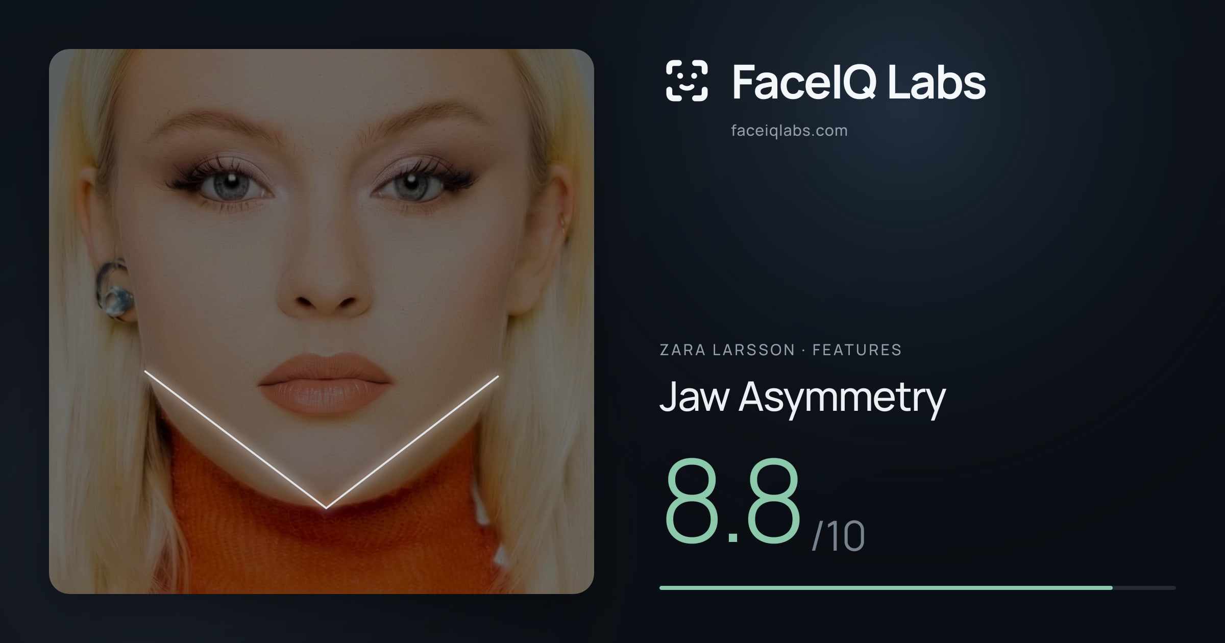 Zara Larsson Jaw Asymmetry: 8.8/10, drawn on the photo