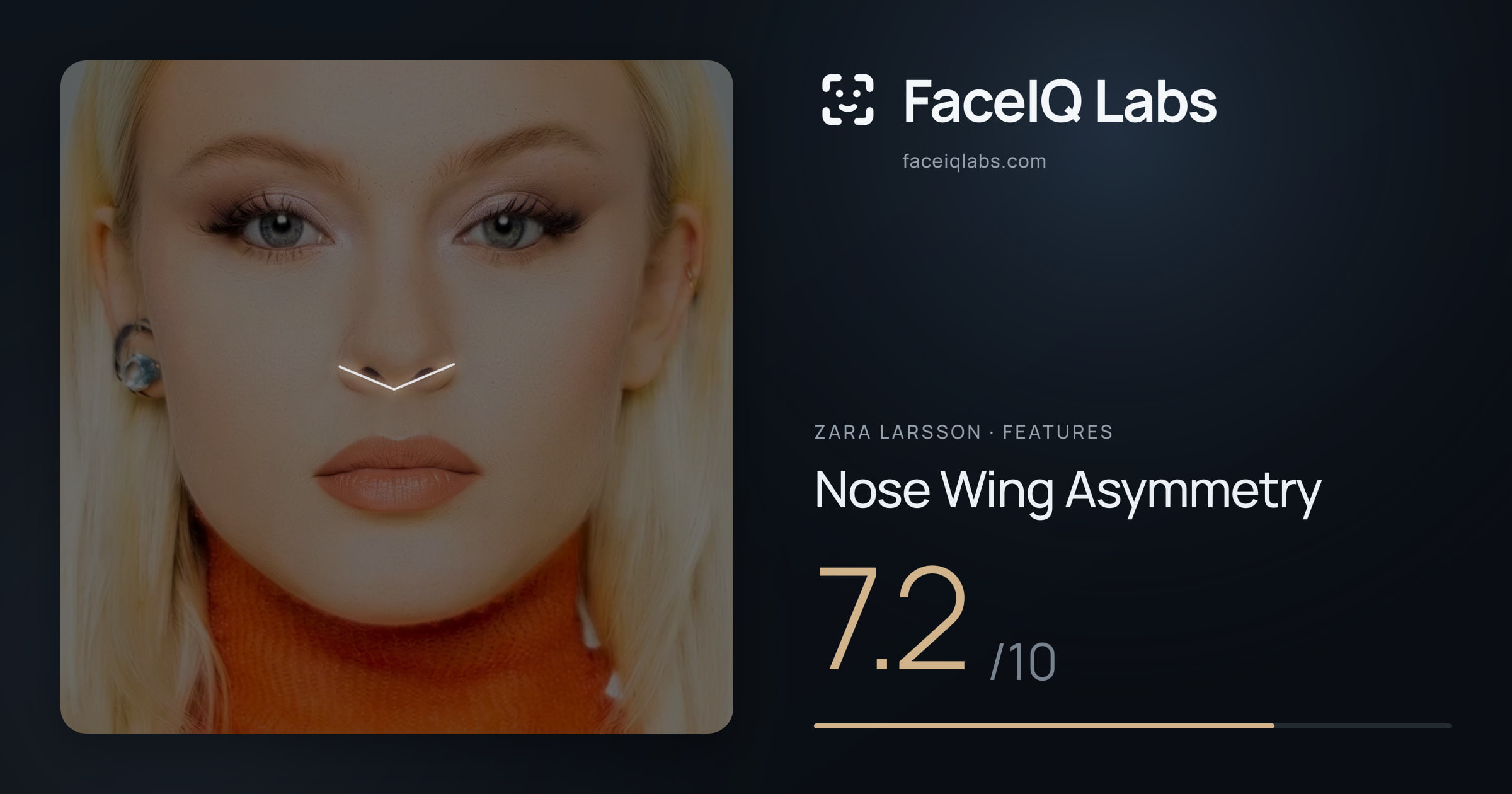 Zara Larsson Nose Wing Asymmetry: 7.2/10, drawn on the photo