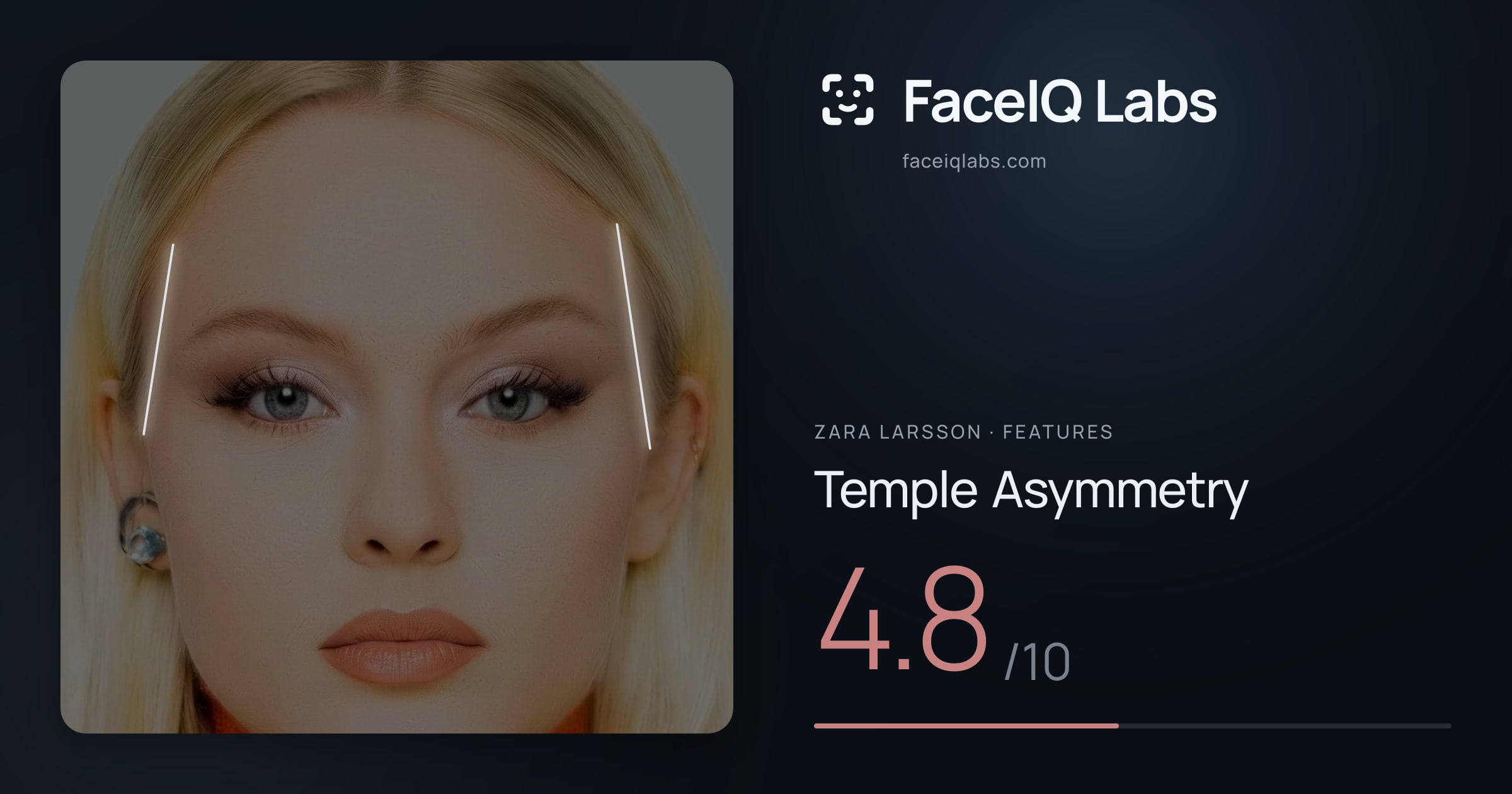 Zara Larsson Temple Asymmetry: 4.8/10, drawn on the photo