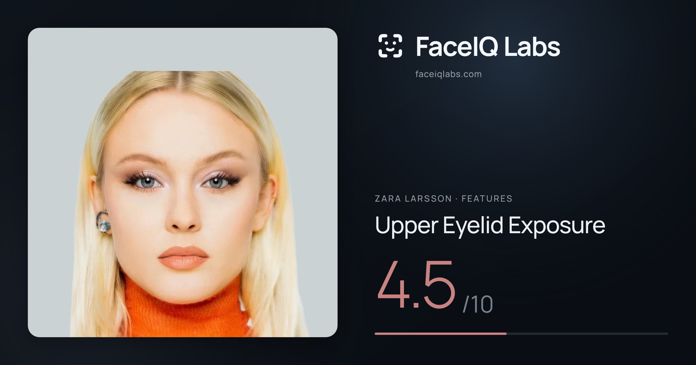Zara Larsson Upper Eyelid Exposure: 4.5/10, drawn on the photo