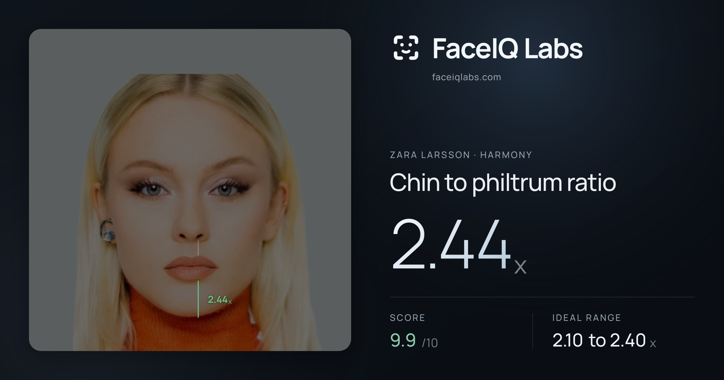 Zara Larsson Chin to philtrum ratio: 2.44x, drawn on the photo