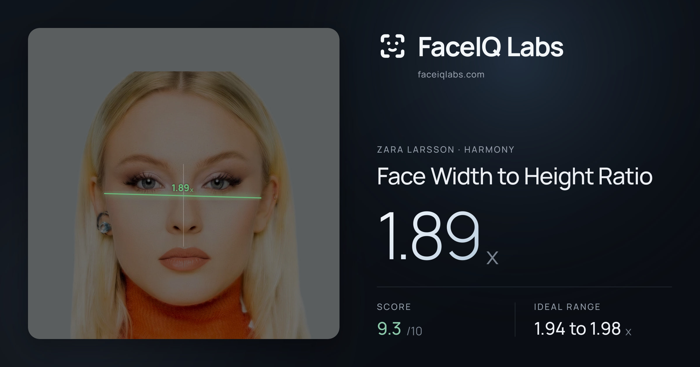 Zara Larsson Face Width to Height Ratio: 1.89x, drawn on the photo