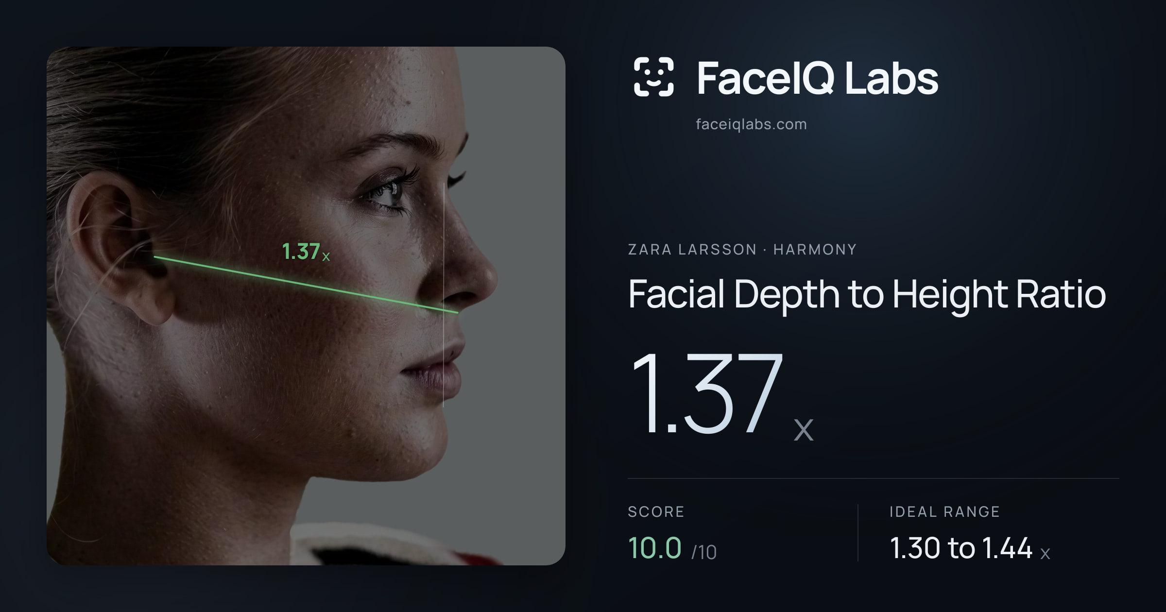 Zara Larsson Facial Depth to Height Ratio: 1.37x, drawn on the photo