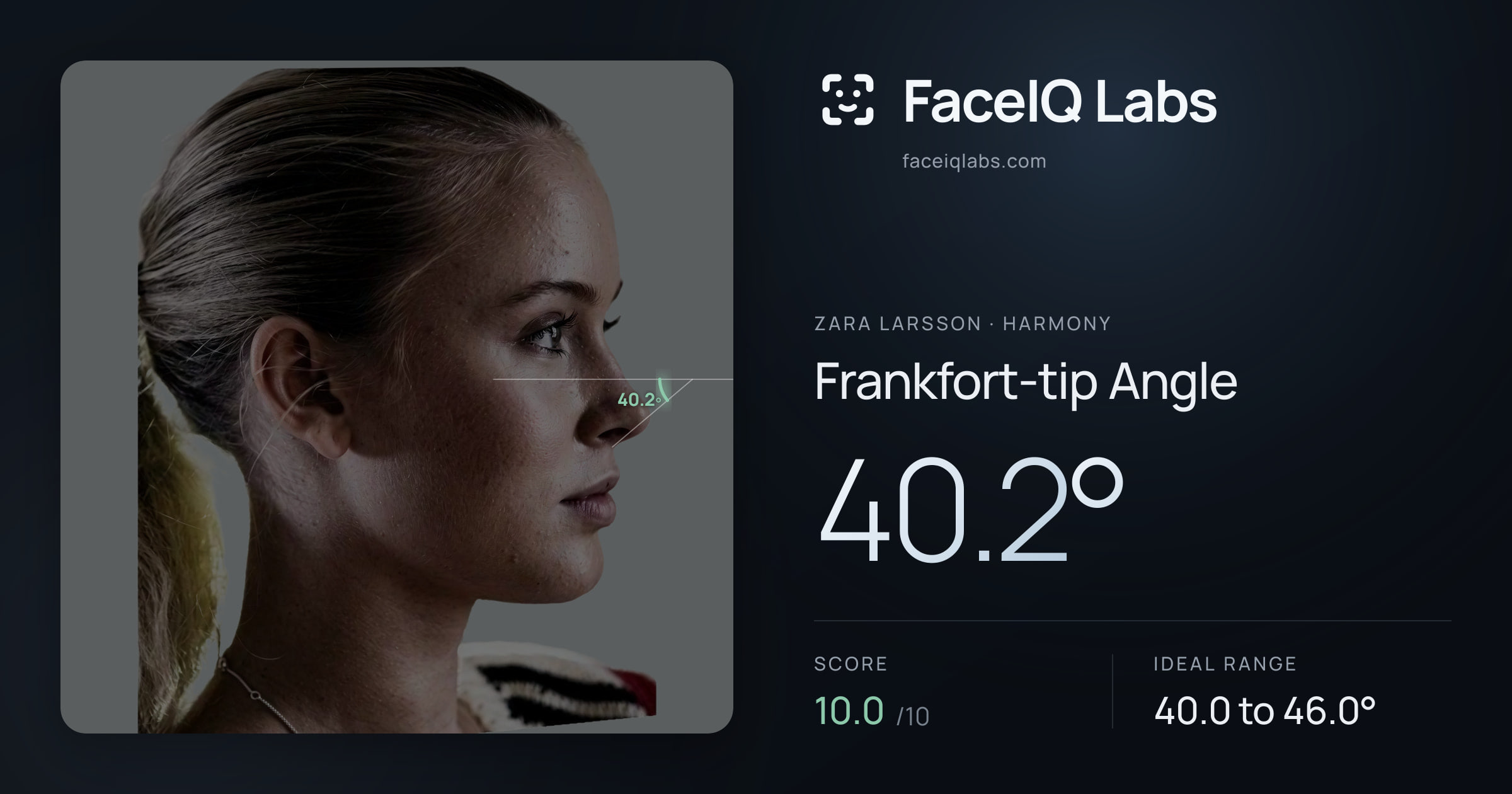 Zara Larsson Frankfort-tip Angle: 40.2°, drawn on the photo