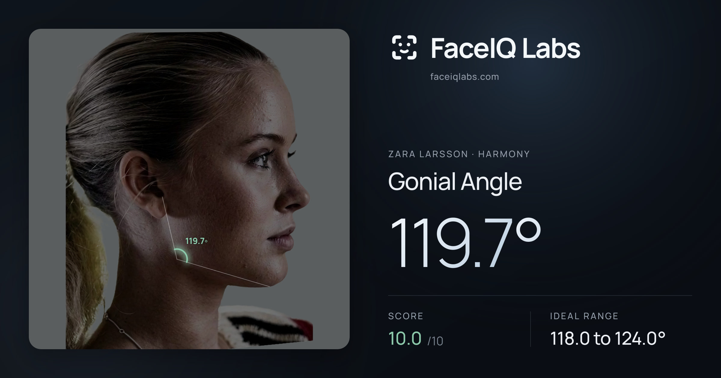 Zara Larsson Gonial Angle: 119.7°, drawn on the photo