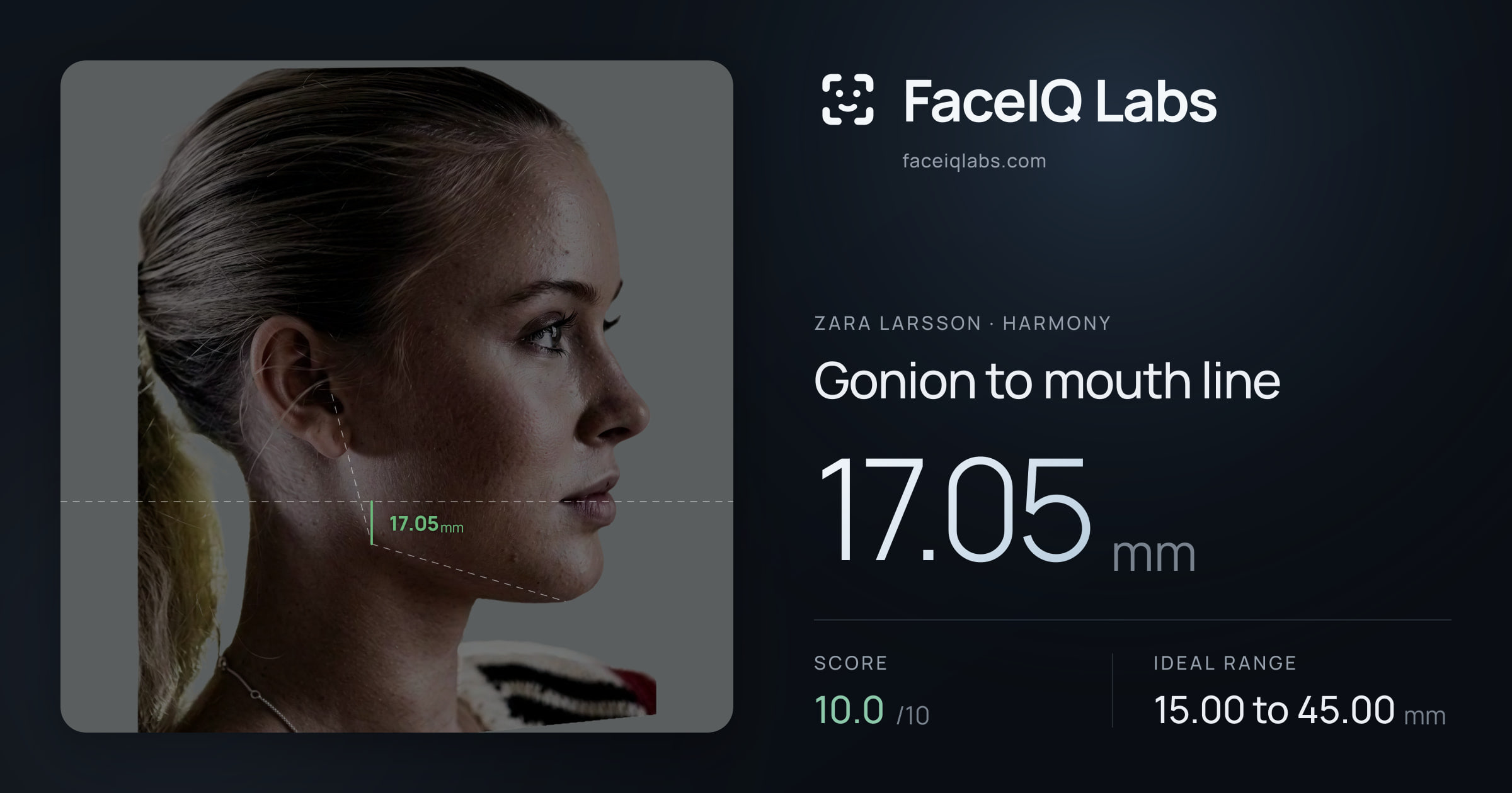 Zara Larsson Gonion to mouth line: 17.05mm, drawn on the photo