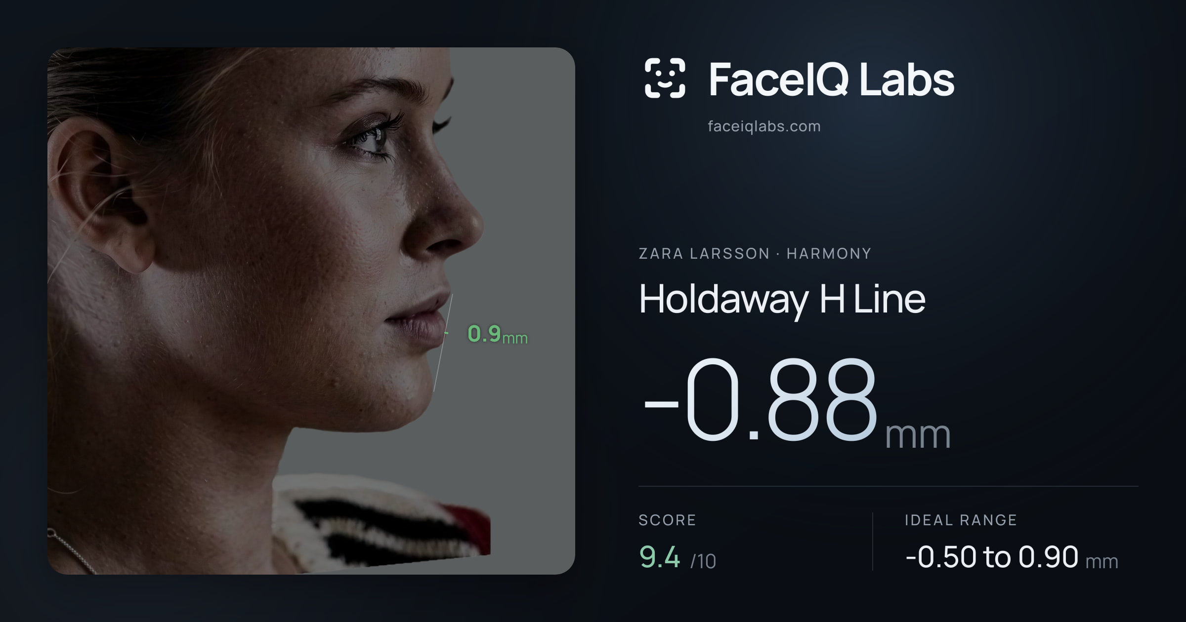 Zara Larsson Holdaway H Line: -0.88mm, drawn on the photo