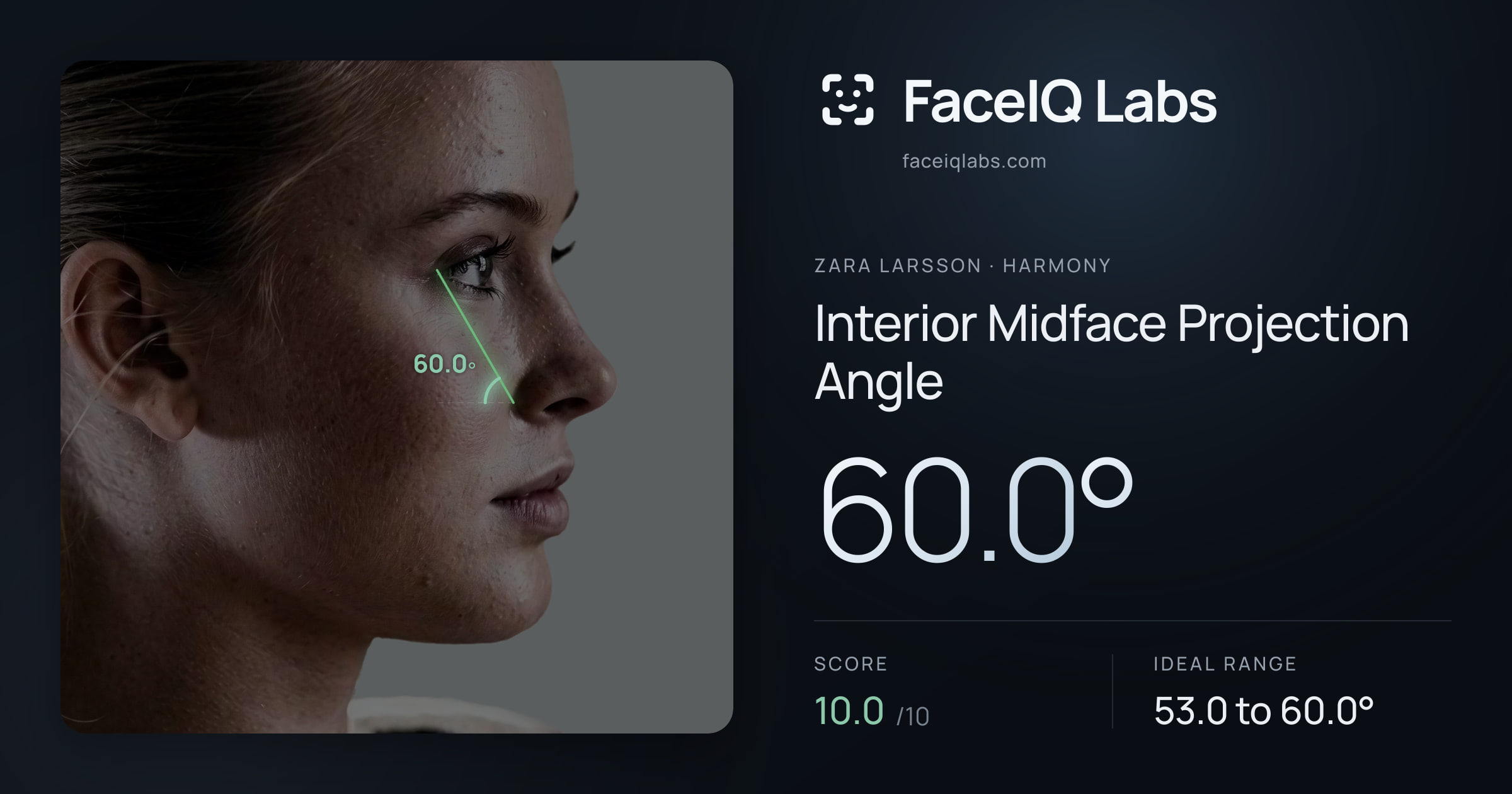 Zara Larsson Interior Midface Projection Angle: 60.0°, drawn on the photo