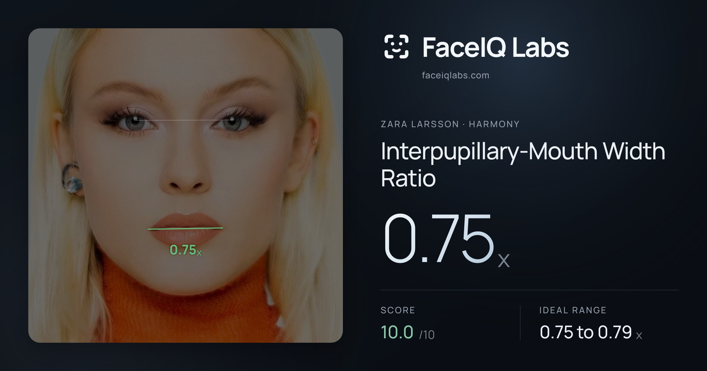Zara Larsson Interpupillary-Mouth Width Ratio: 0.75x, drawn on the photo