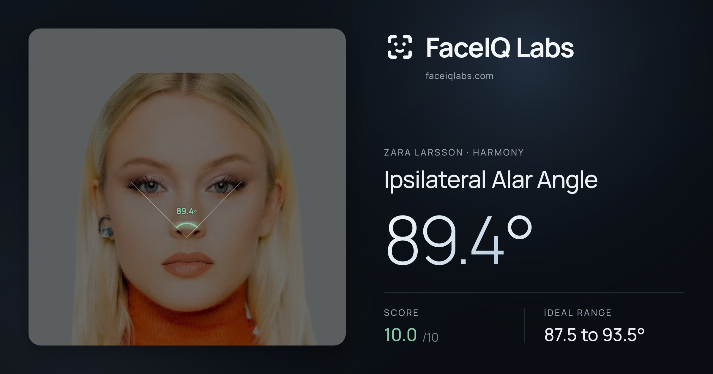 Zara Larsson Ipsilateral Alar Angle: 89.4°, drawn on the photo
