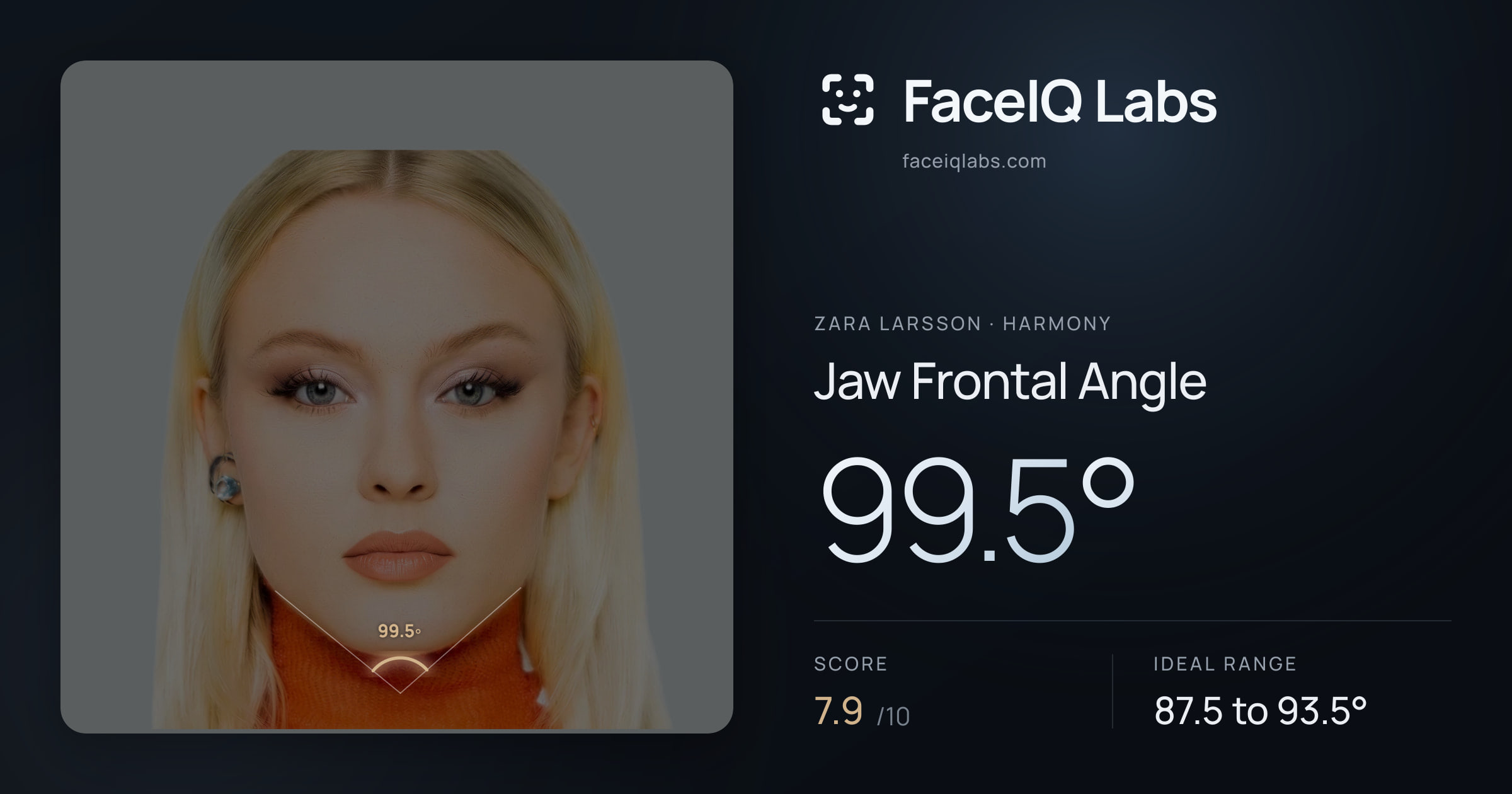 Zara Larsson Jaw Frontal Angle: 99.5°, drawn on the photo