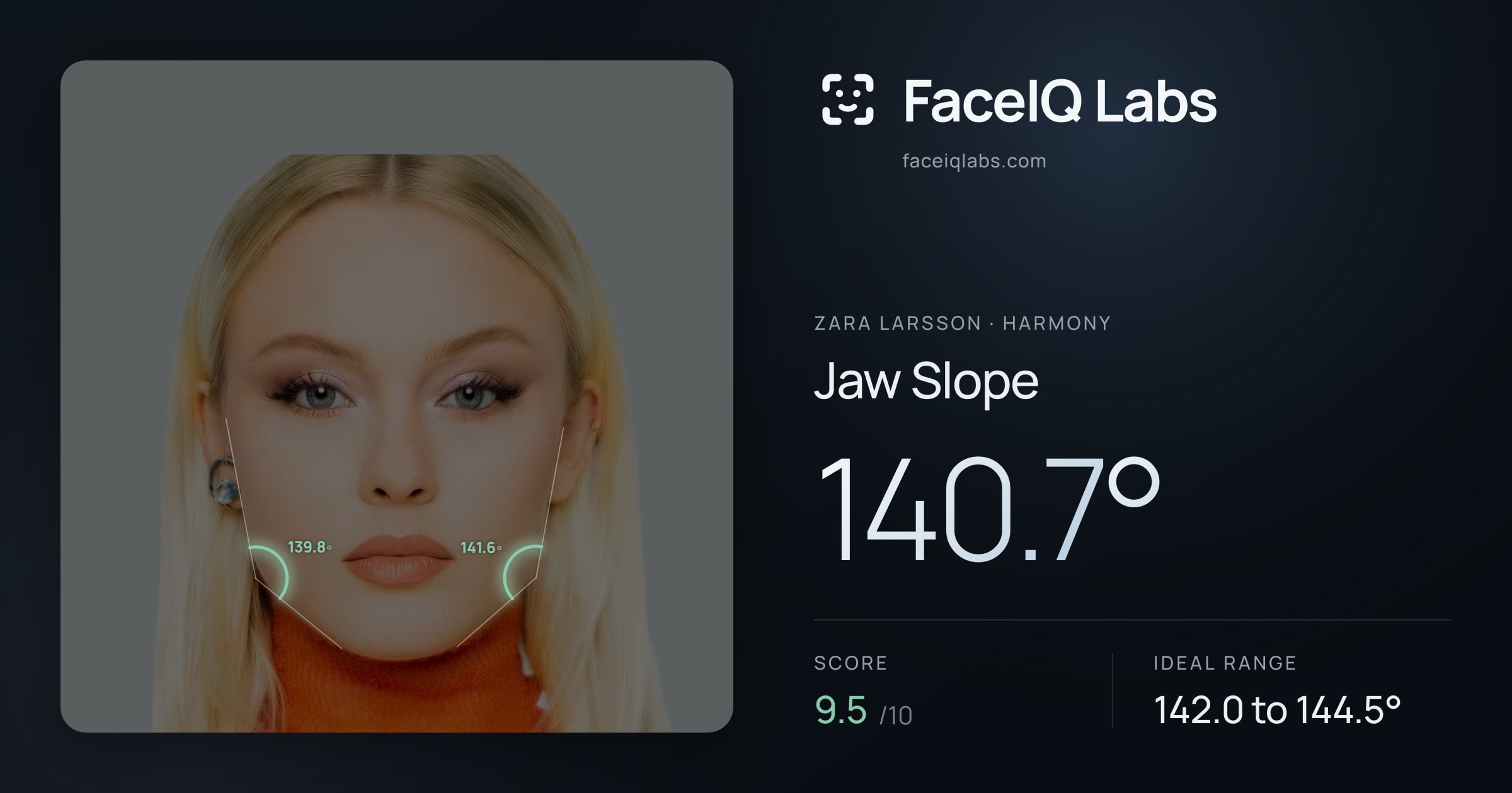 Zara Larsson Jaw Slope: 140.7°, drawn on the photo