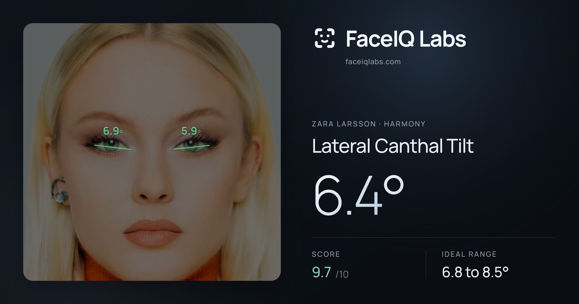 Zara Larsson Lateral Canthal Tilt: 6.4°, drawn on the photo