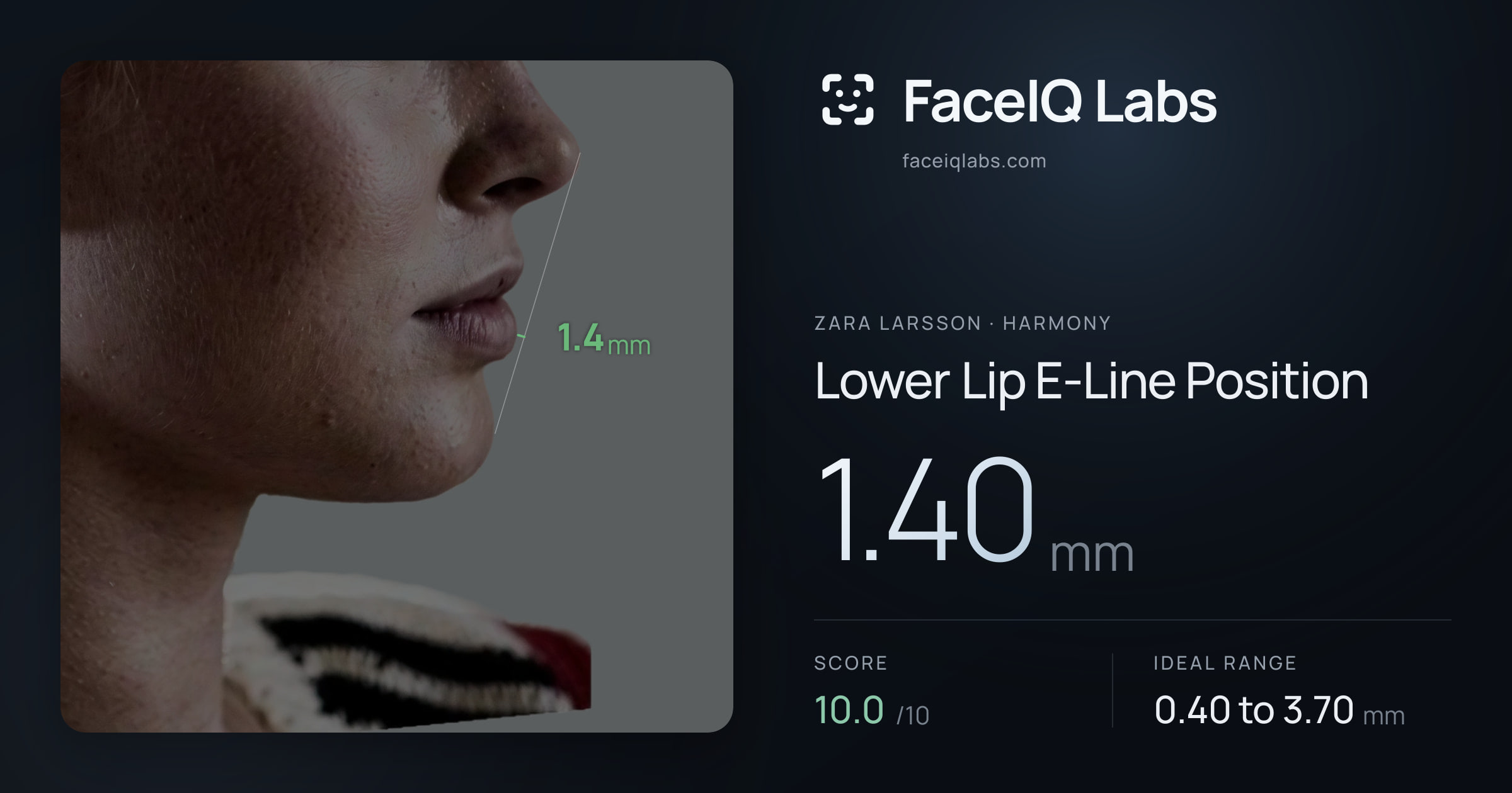 Zara Larsson Lower Lip E-Line Position: 1.40mm, drawn on the photo