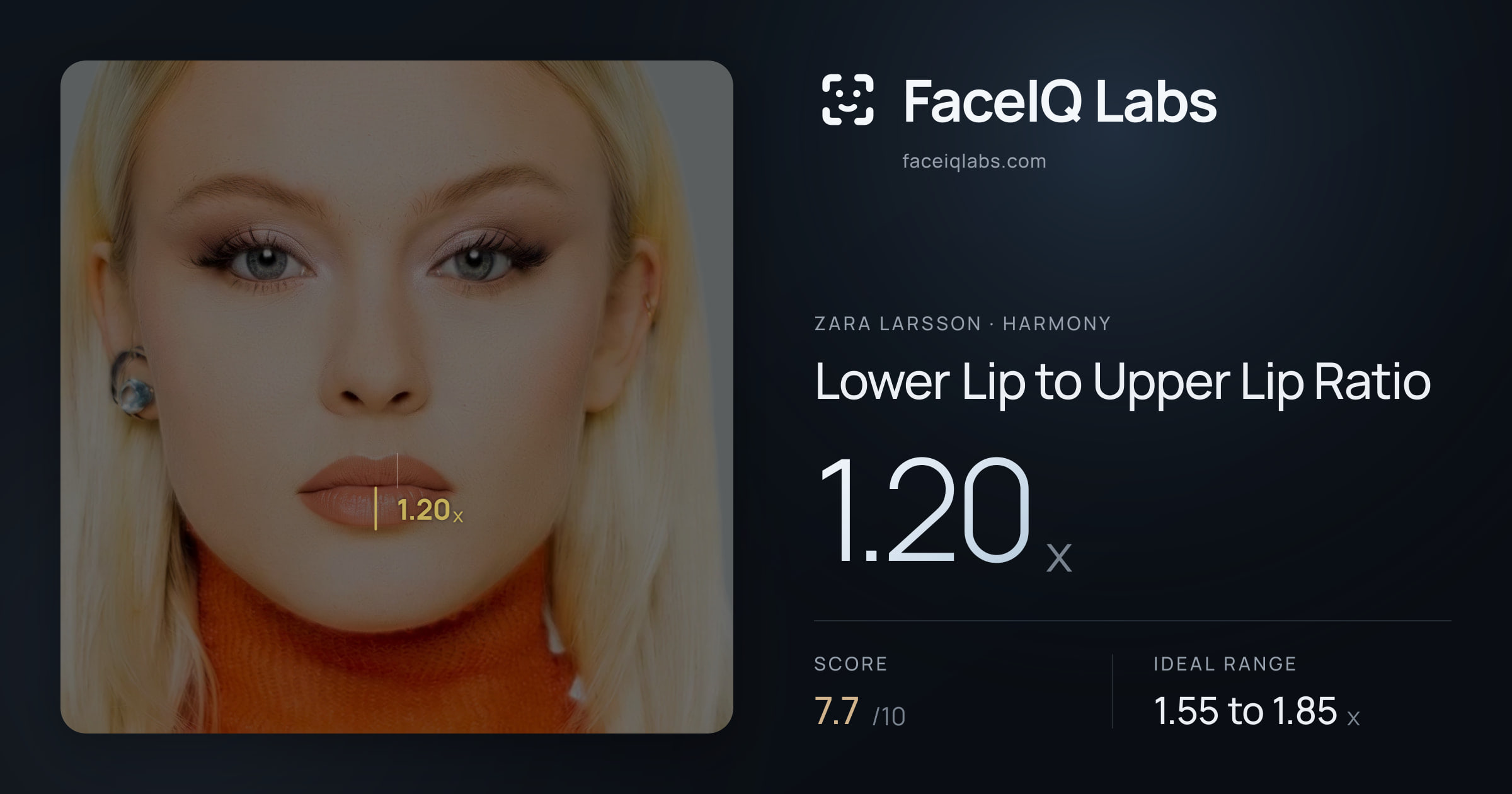Zara Larsson Lower Lip to Upper Lip Ratio: 1.20x, drawn on the photo