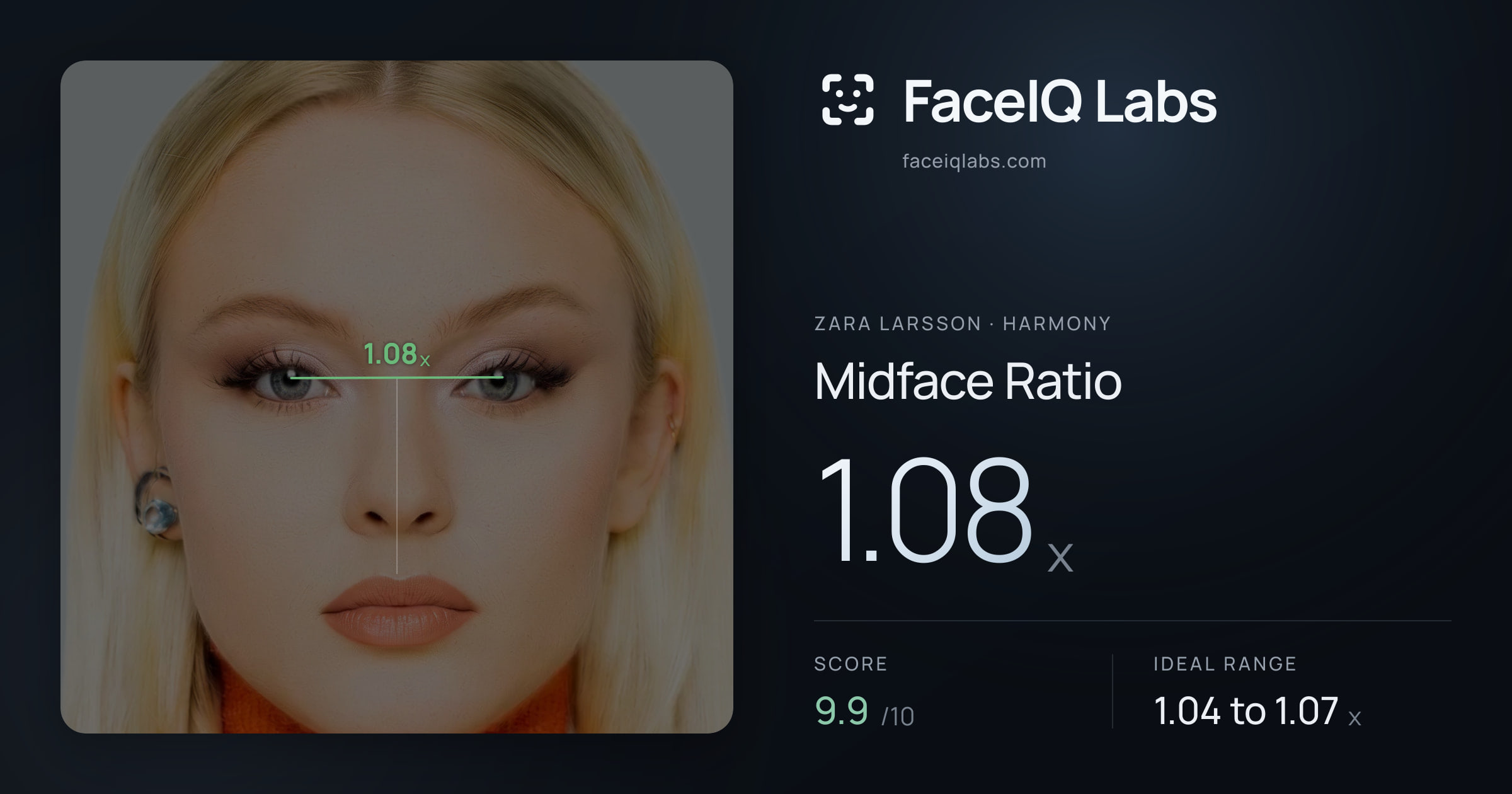Zara Larsson Midface Ratio: 1.08x, drawn on the photo