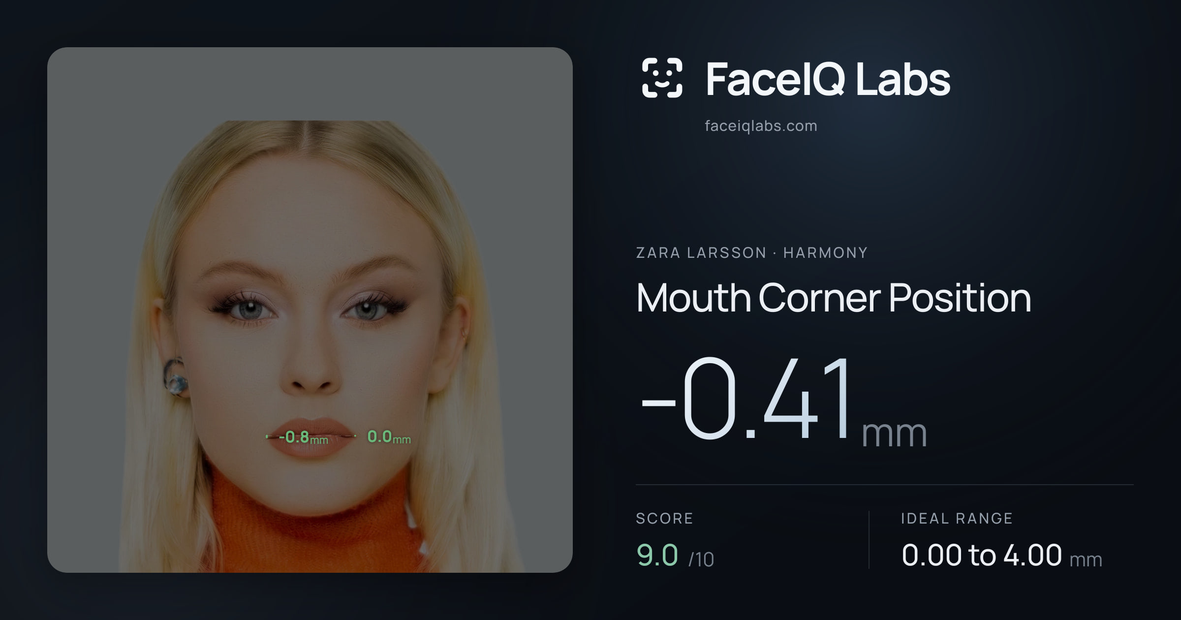 Zara Larsson Mouth Corner Position: -0.41mm, drawn on the photo