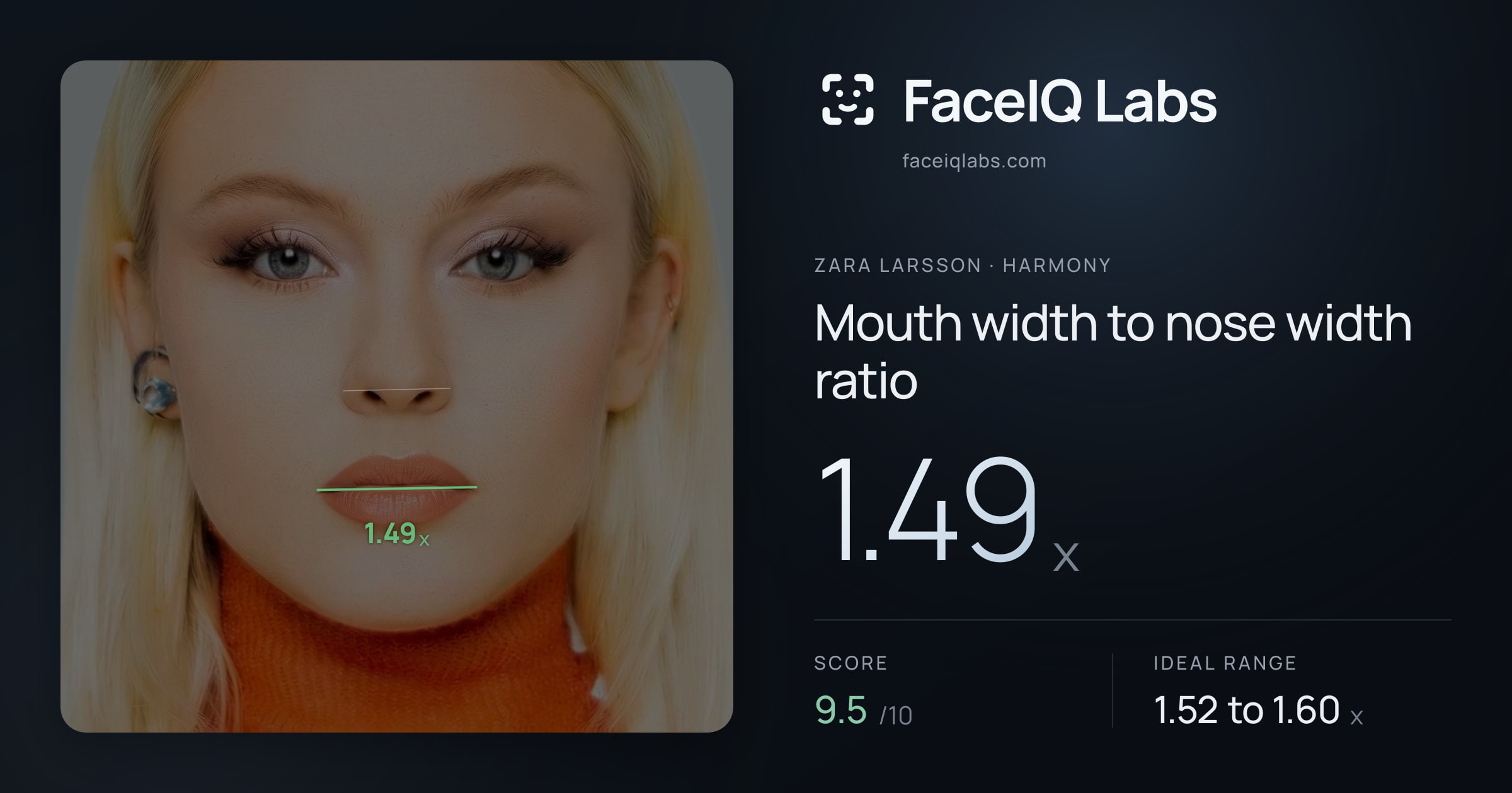Zara Larsson Mouth width to nose width ratio: 1.49x, drawn on the photo