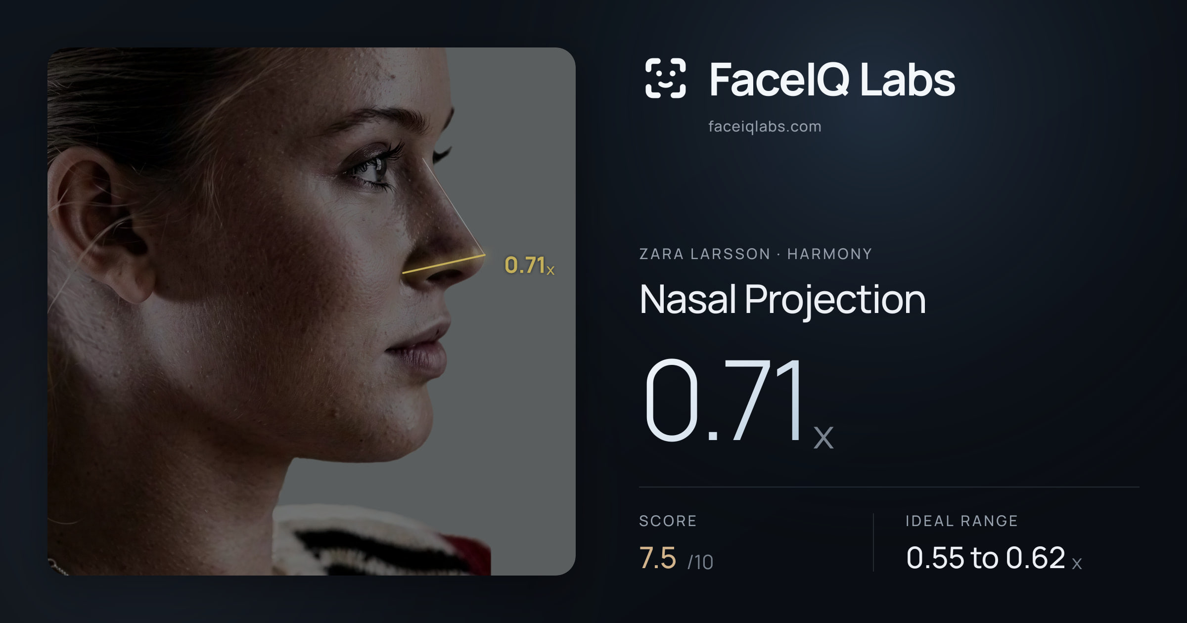 Zara Larsson Nasal Projection: 0.71x, drawn on the photo