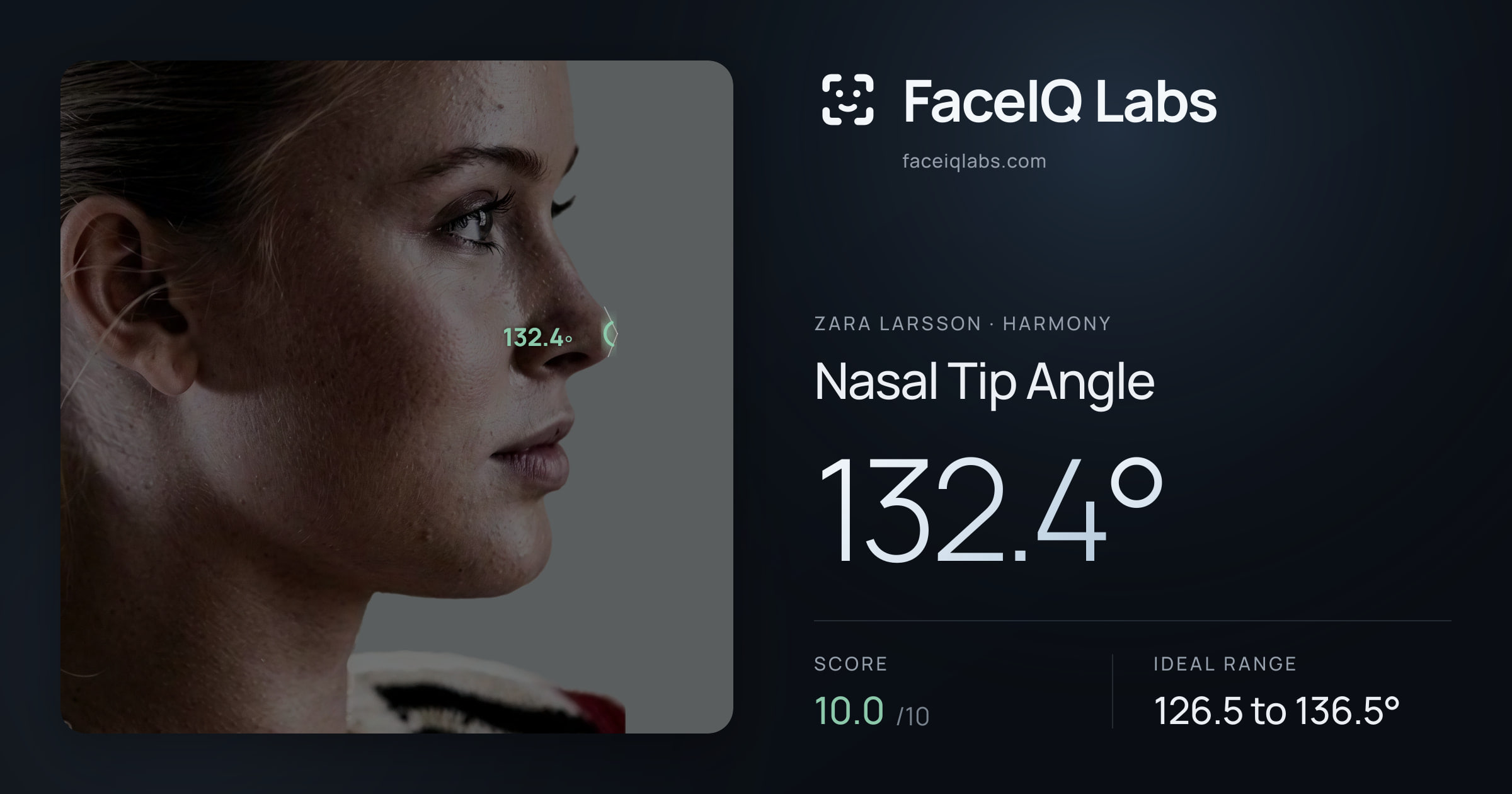 Zara Larsson Nasal Tip Angle: 132.4°, drawn on the photo