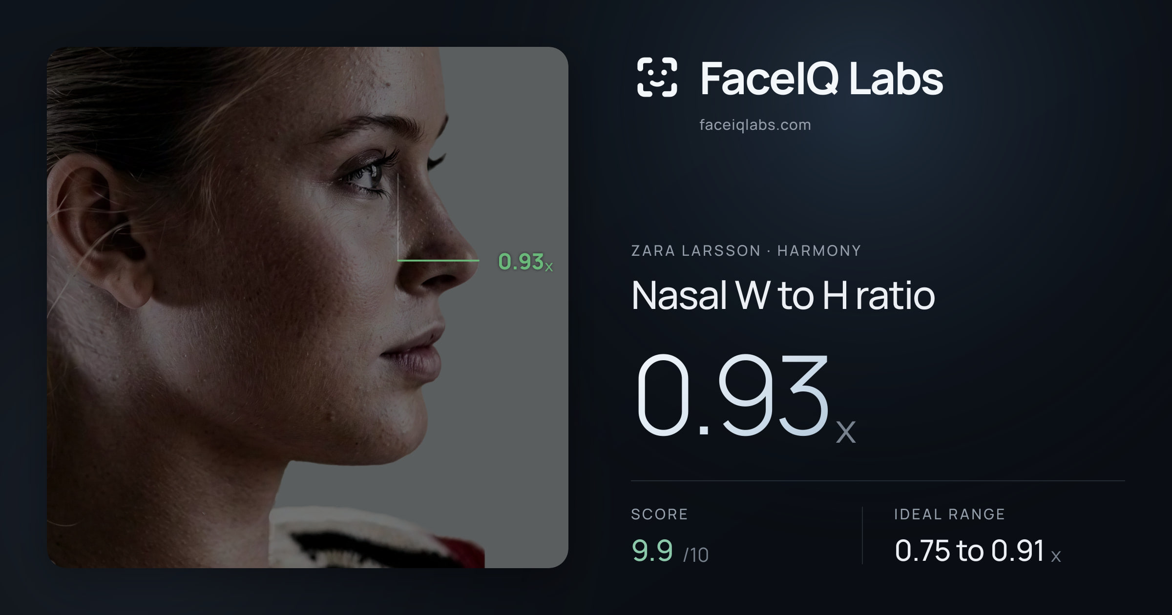 Zara Larsson Nasal W to H ratio: 0.93x, drawn on the photo