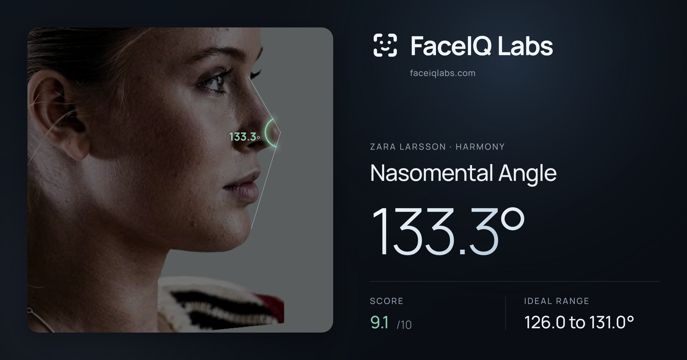 Zara Larsson Nasomental Angle: 133.3°, drawn on the photo