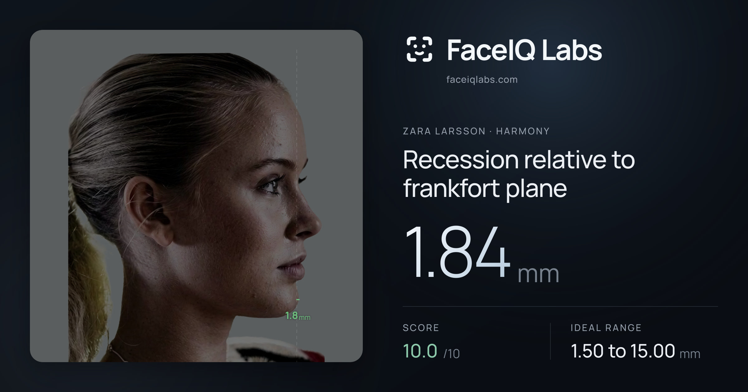 Zara Larsson Recession relative to frankfort plane: 1.84mm, drawn on the photo