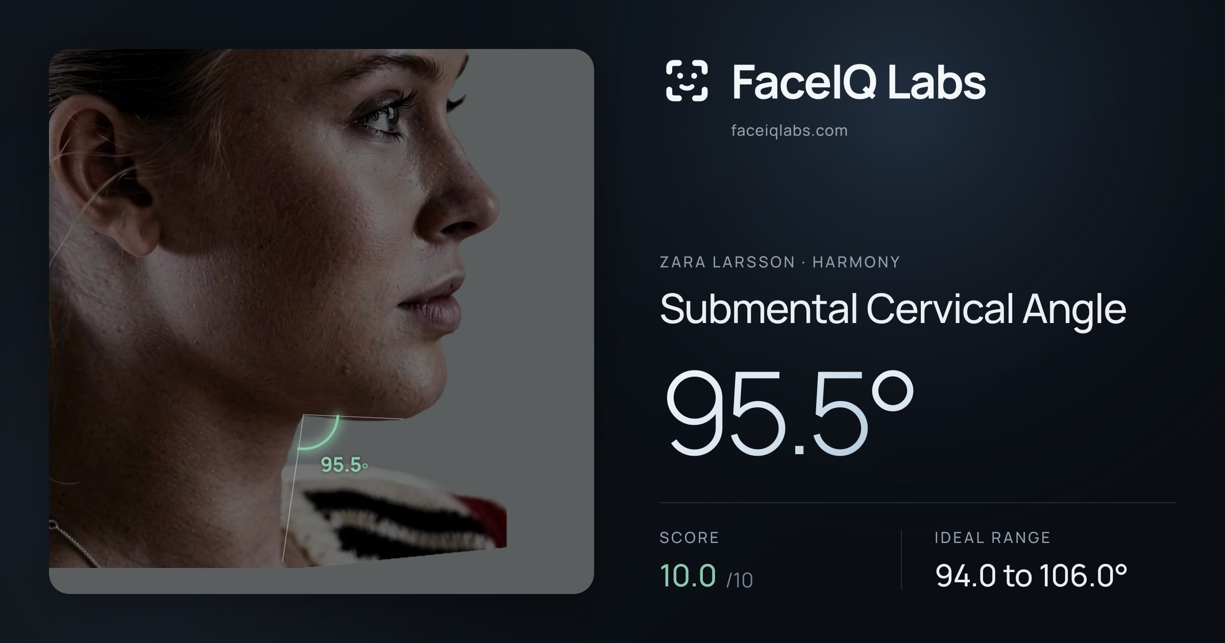 Zara Larsson Submental Cervical Angle: 95.5°, drawn on the photo