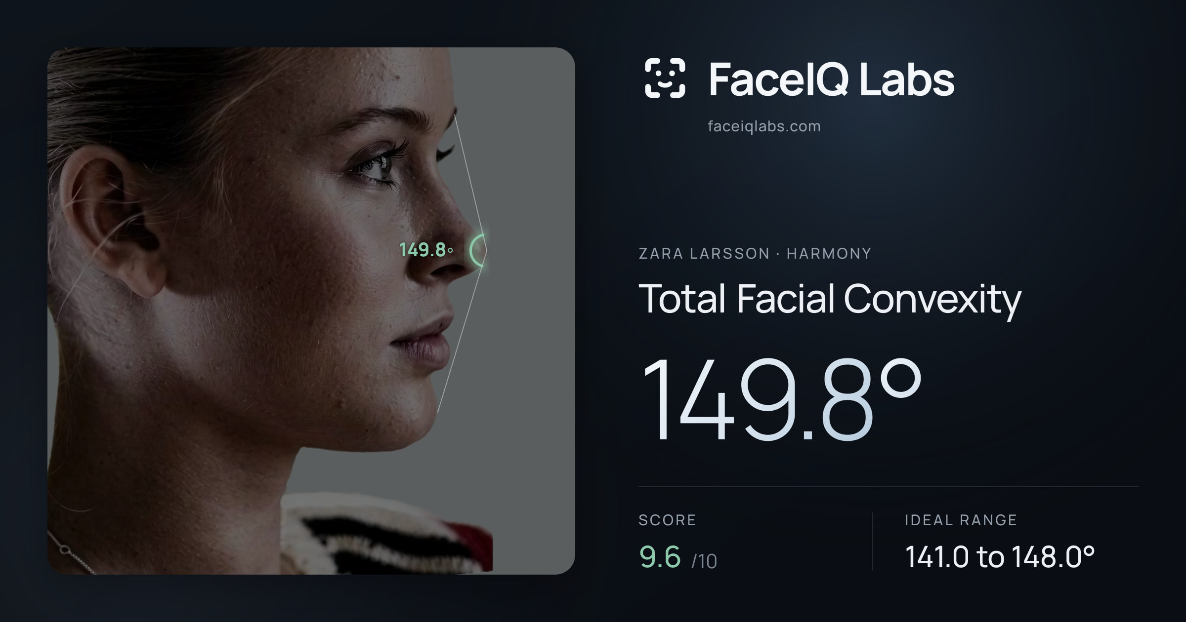 Zara Larsson Total Facial Convexity: 149.8°, drawn on the photo
