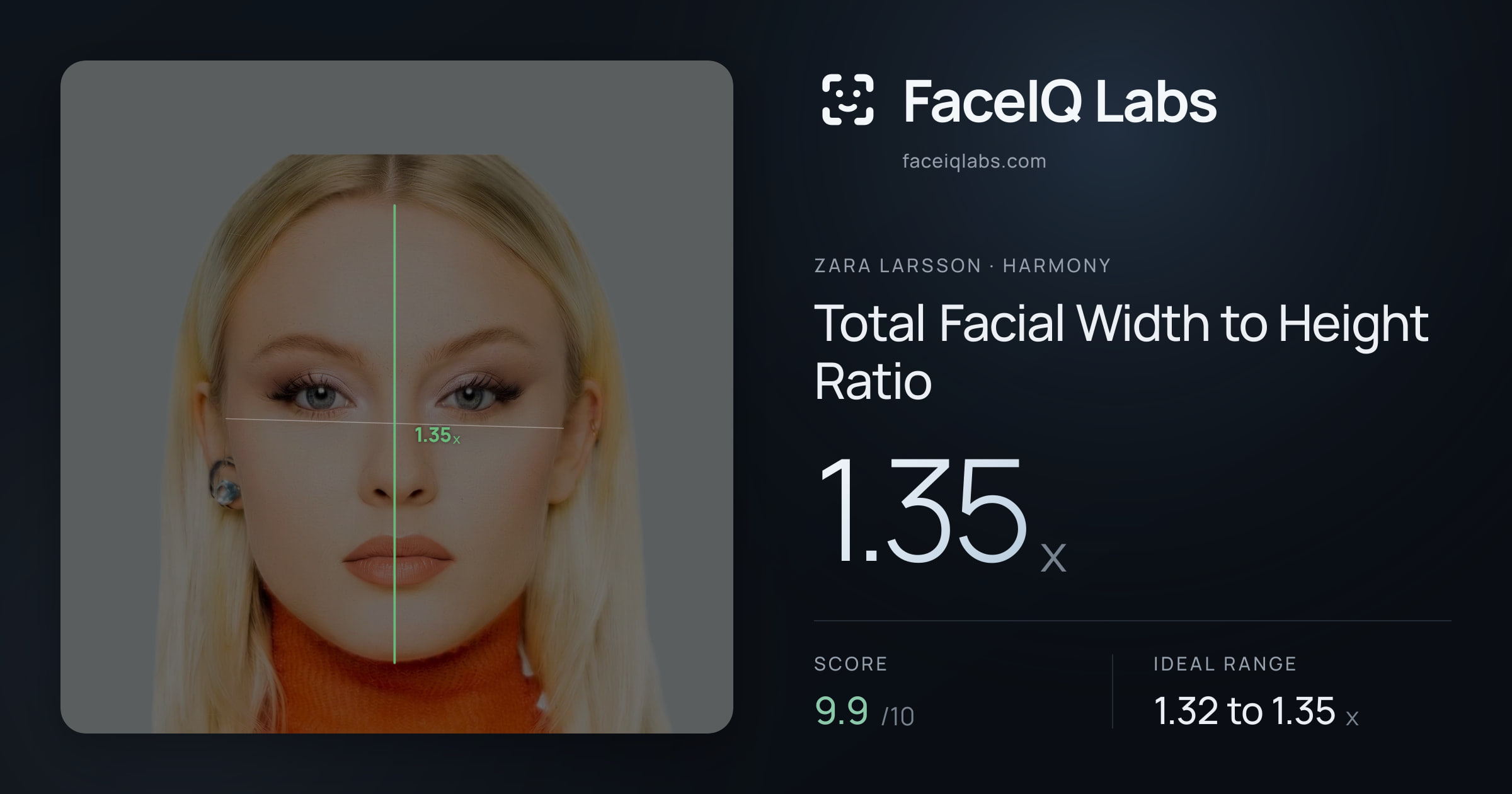 Zara Larsson Total Facial Width to Height Ratio: 1.35x, drawn on the photo