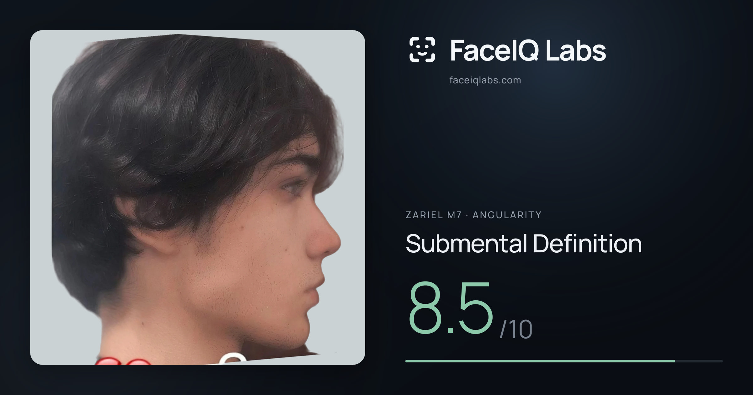 Zariel M7 Submental Definition: 8.5/10, drawn on the photo