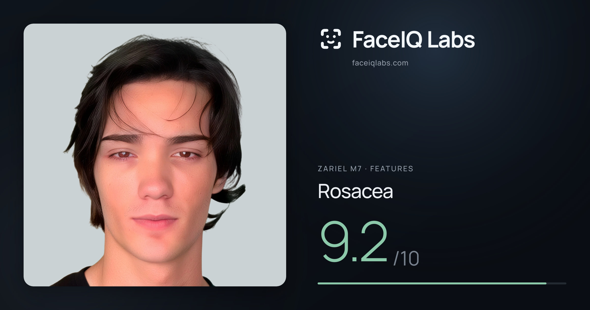 Zariel M7 Rosacea: 9.2/10, drawn on the photo