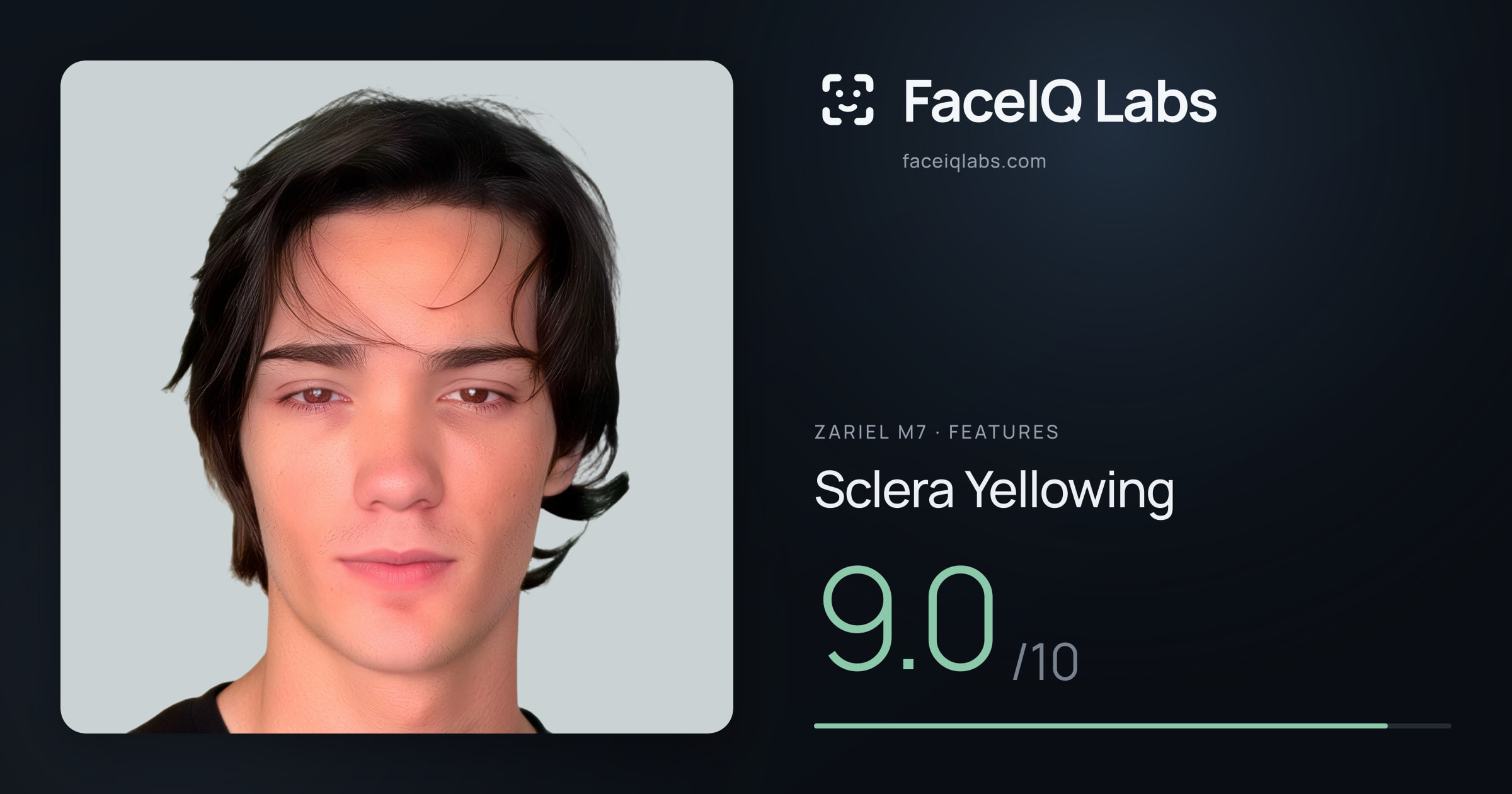 Zariel M7 Sclera Yellowing: 9.0/10, drawn on the photo
