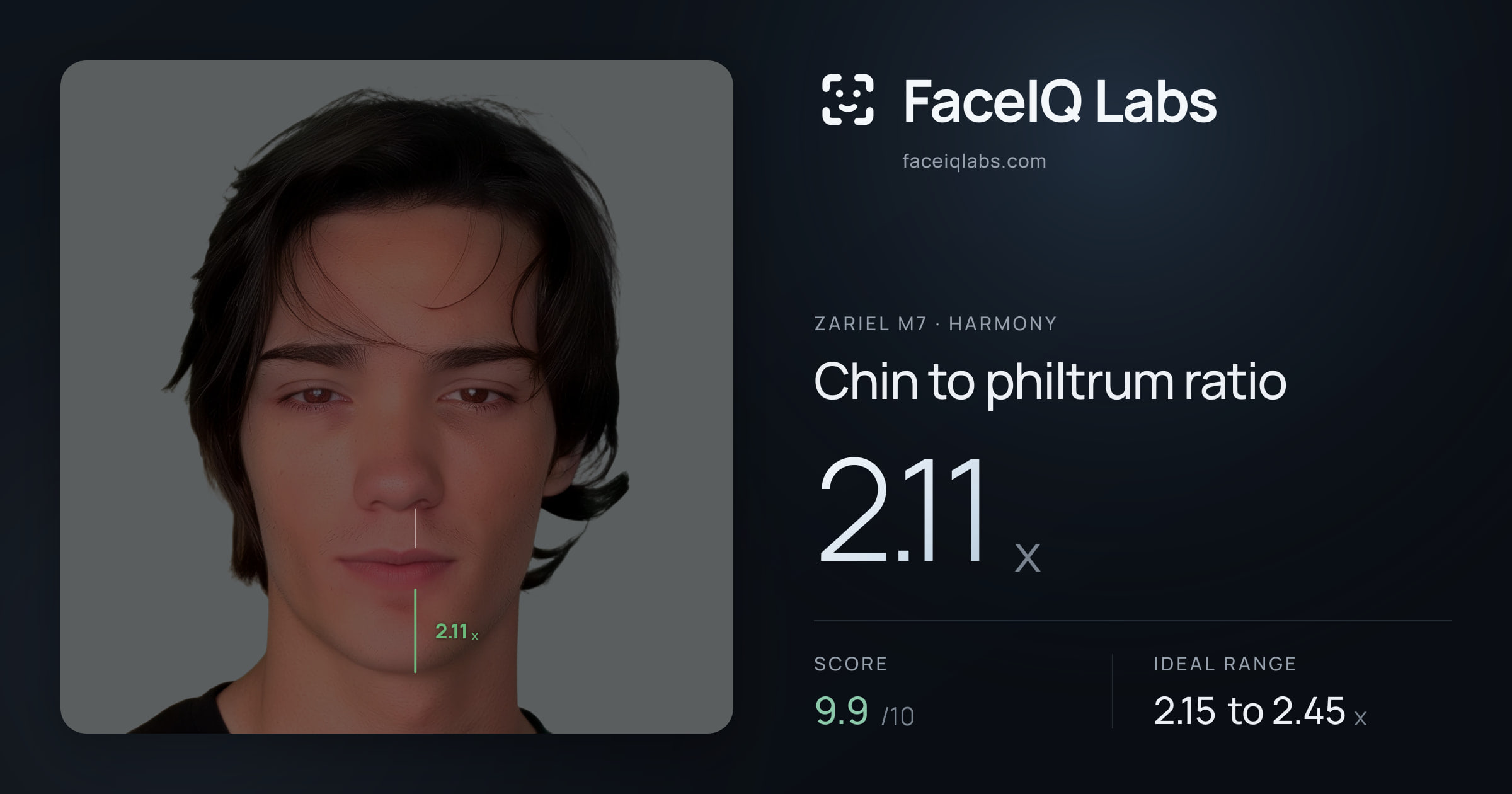 Zariel M7 Chin to philtrum ratio: 2.11x, drawn on the photo