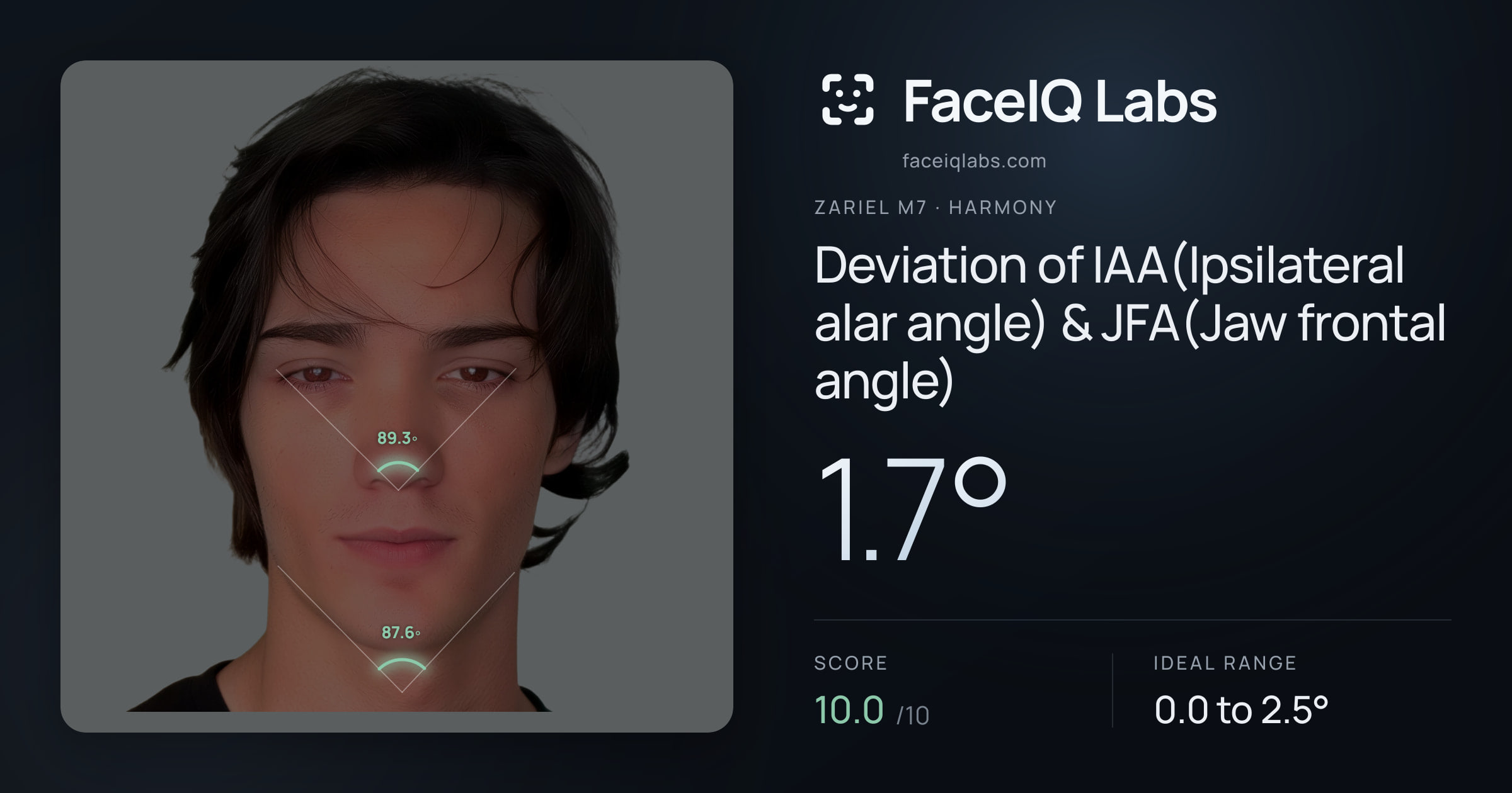 Zariel M7 Deviation of IAA(Ipsilateral alar angle) & JFA(Jaw frontal angle): 1.7°, drawn on the photo