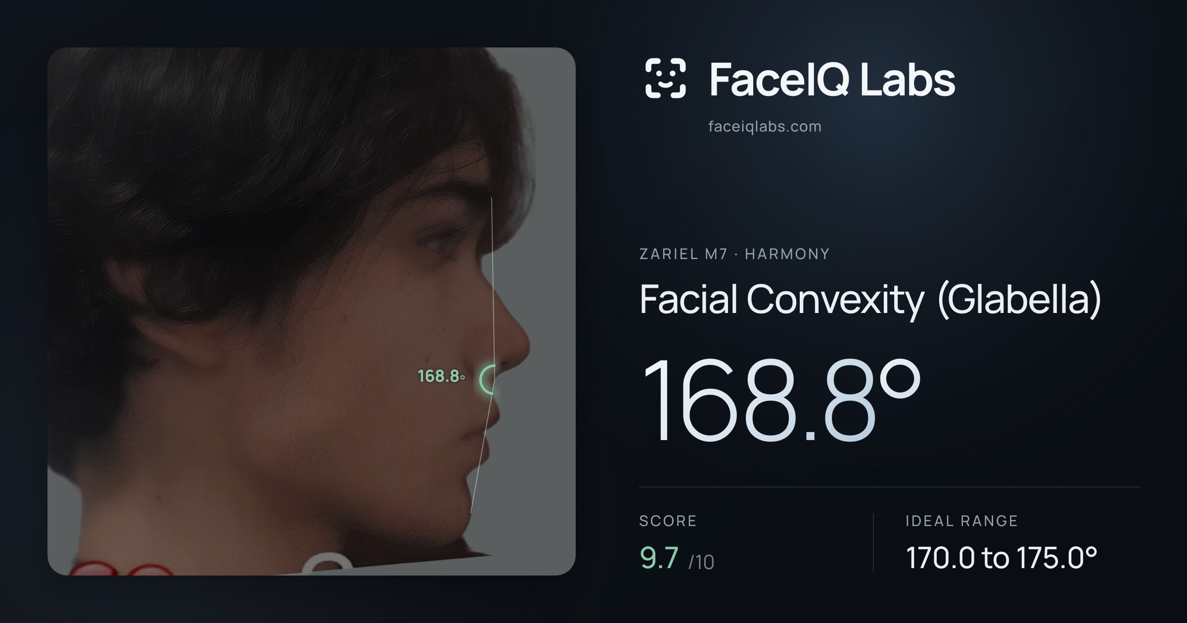Zariel M7 Facial Convexity (Glabella): 168.8°, drawn on the photo