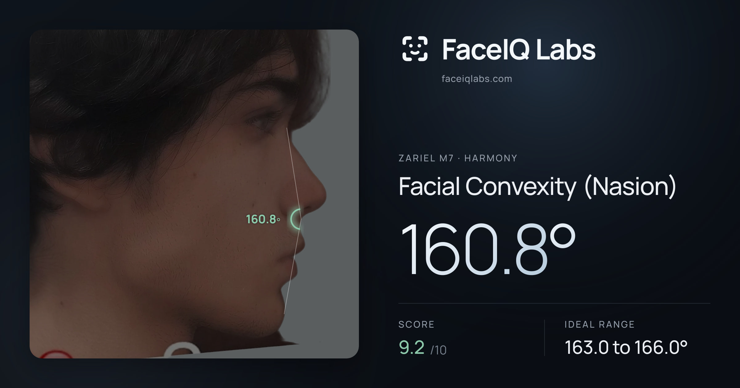 Zariel M7 Facial Convexity (Nasion): 160.8°, drawn on the photo