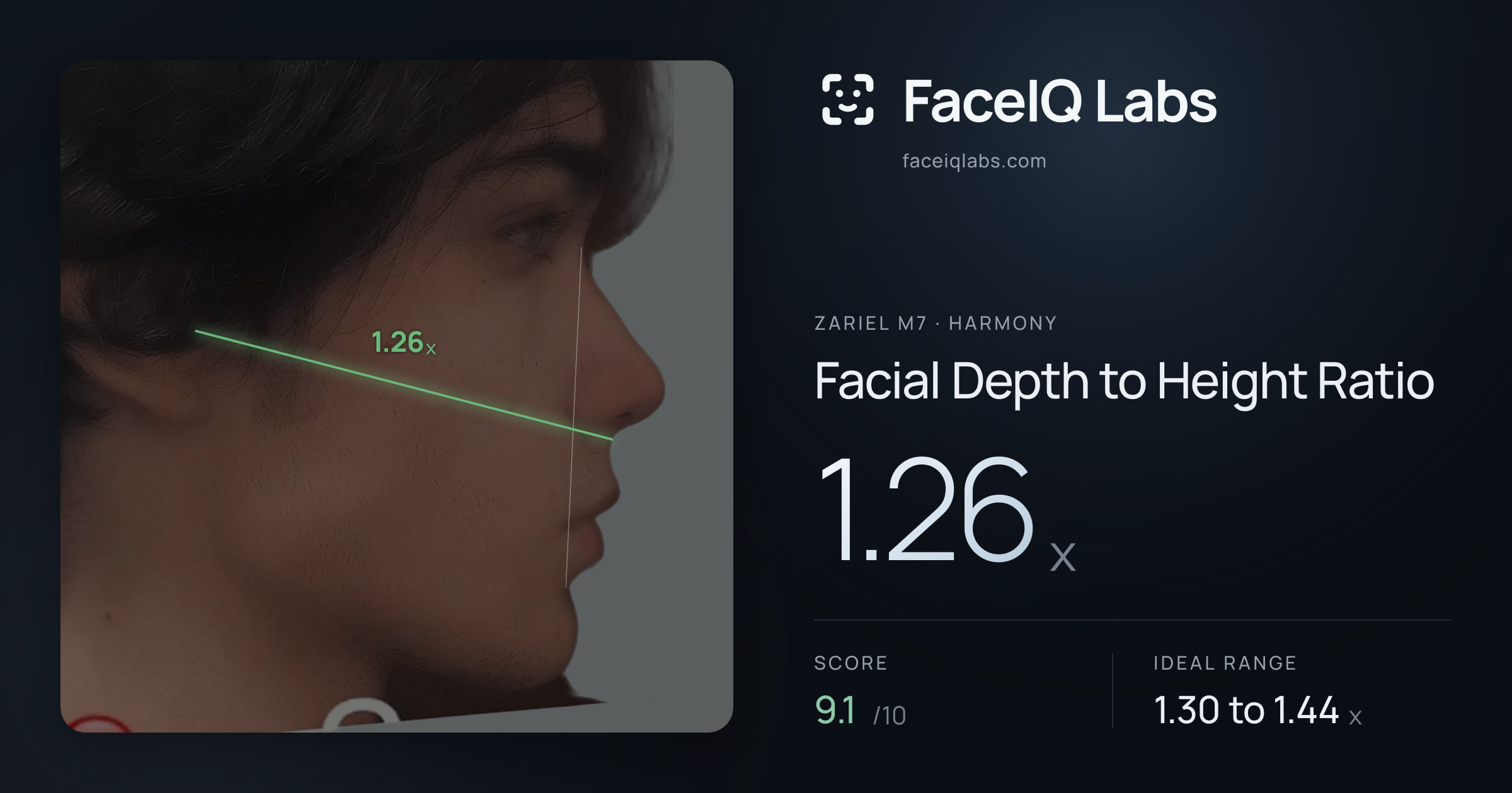 Zariel M7 Facial Depth to Height Ratio: 1.26x, drawn on the photo