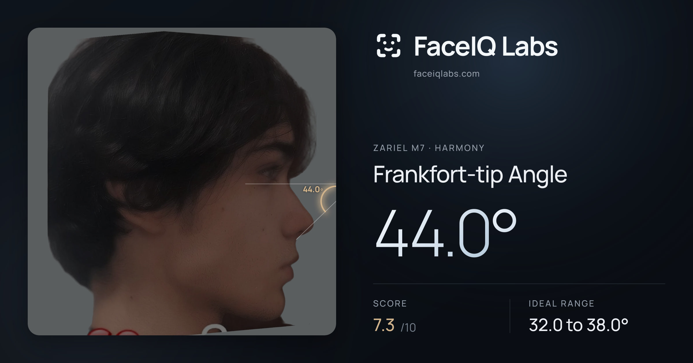 Zariel M7 Frankfort-tip Angle: 44.0°, drawn on the photo