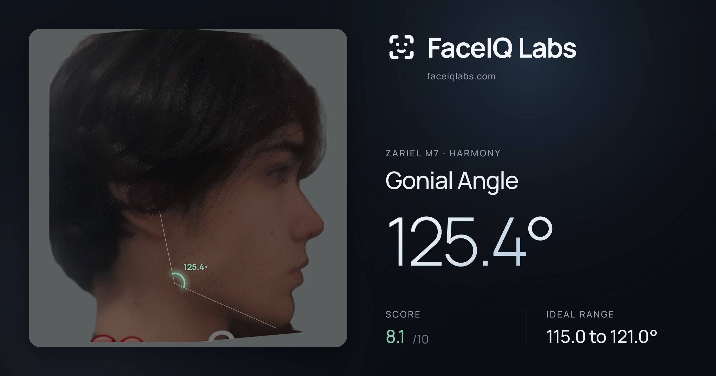 Zariel M7 Gonial Angle: 125.4°, drawn on the photo