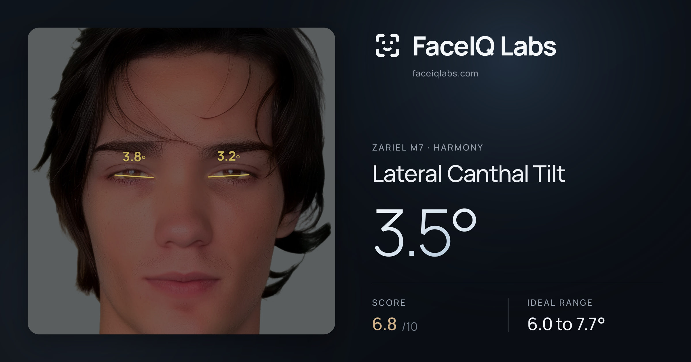 Zariel M7 Lateral Canthal Tilt: 3.5°, drawn on the photo