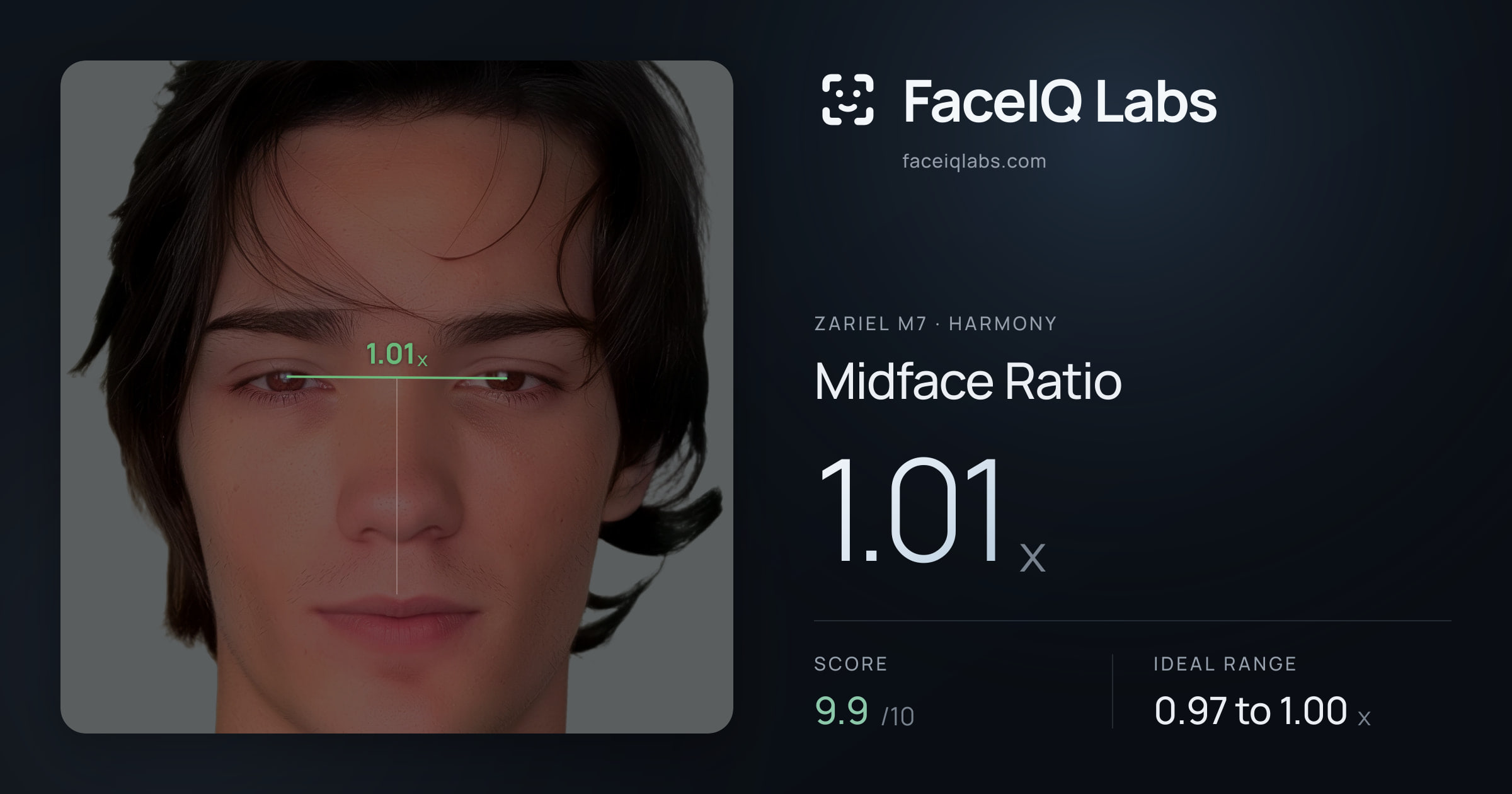 Zariel M7 Midface Ratio: 1.01x, drawn on the photo
