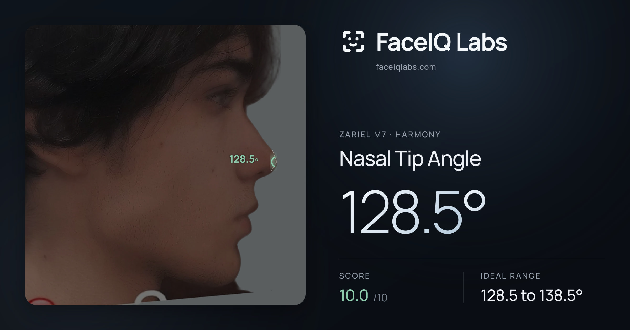 Zariel M7 Nasal Tip Angle: 128.5°, drawn on the photo