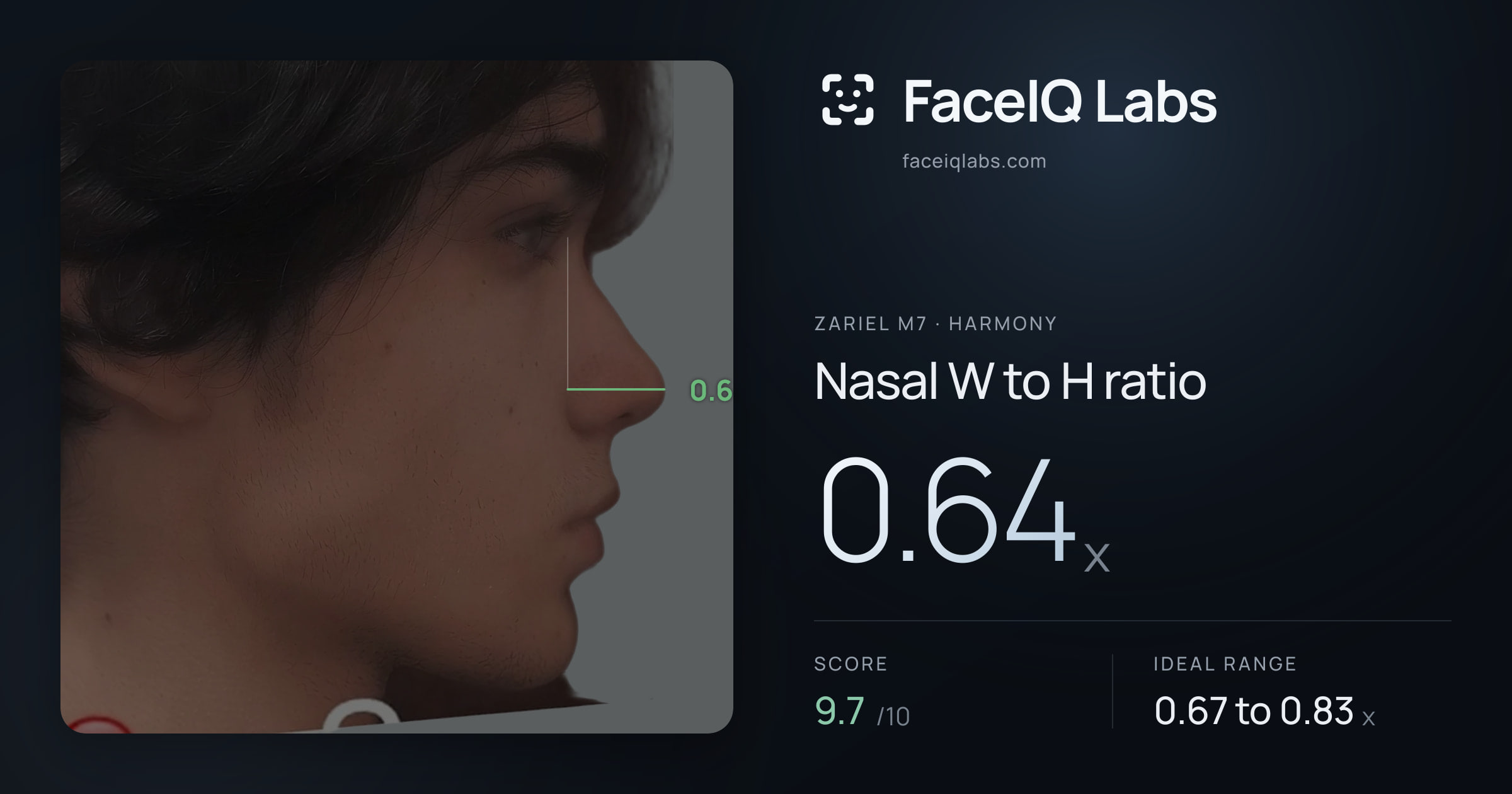 Zariel M7 Nasal W to H ratio: 0.64x, drawn on the photo