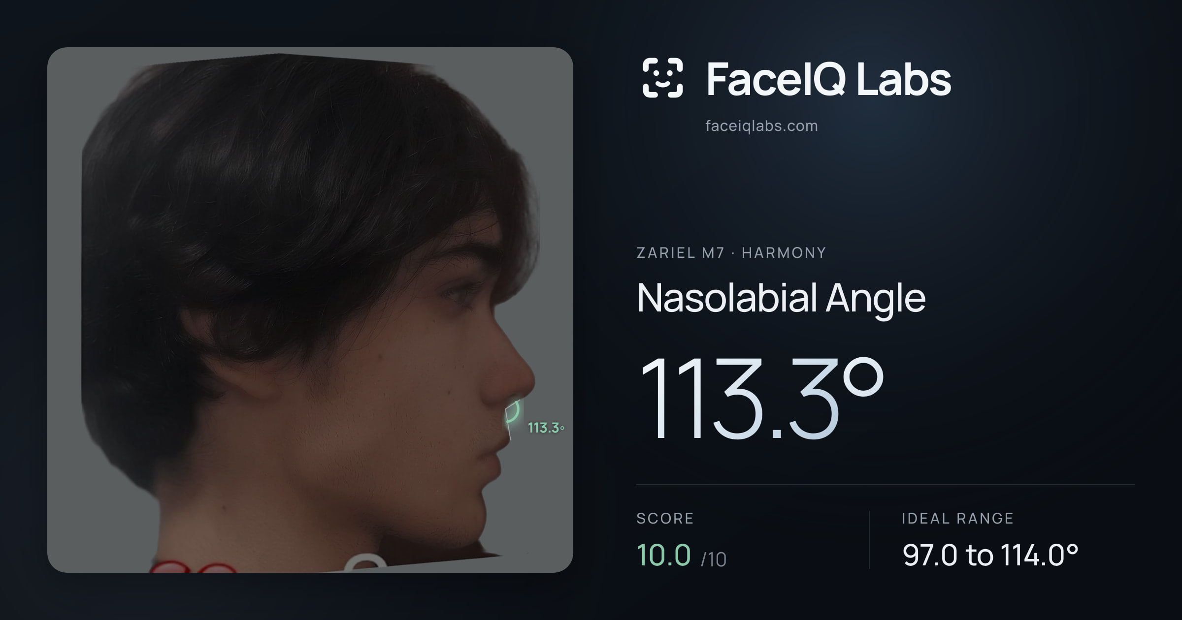 Zariel M7 Nasolabial Angle: 113.3°, drawn on the photo
