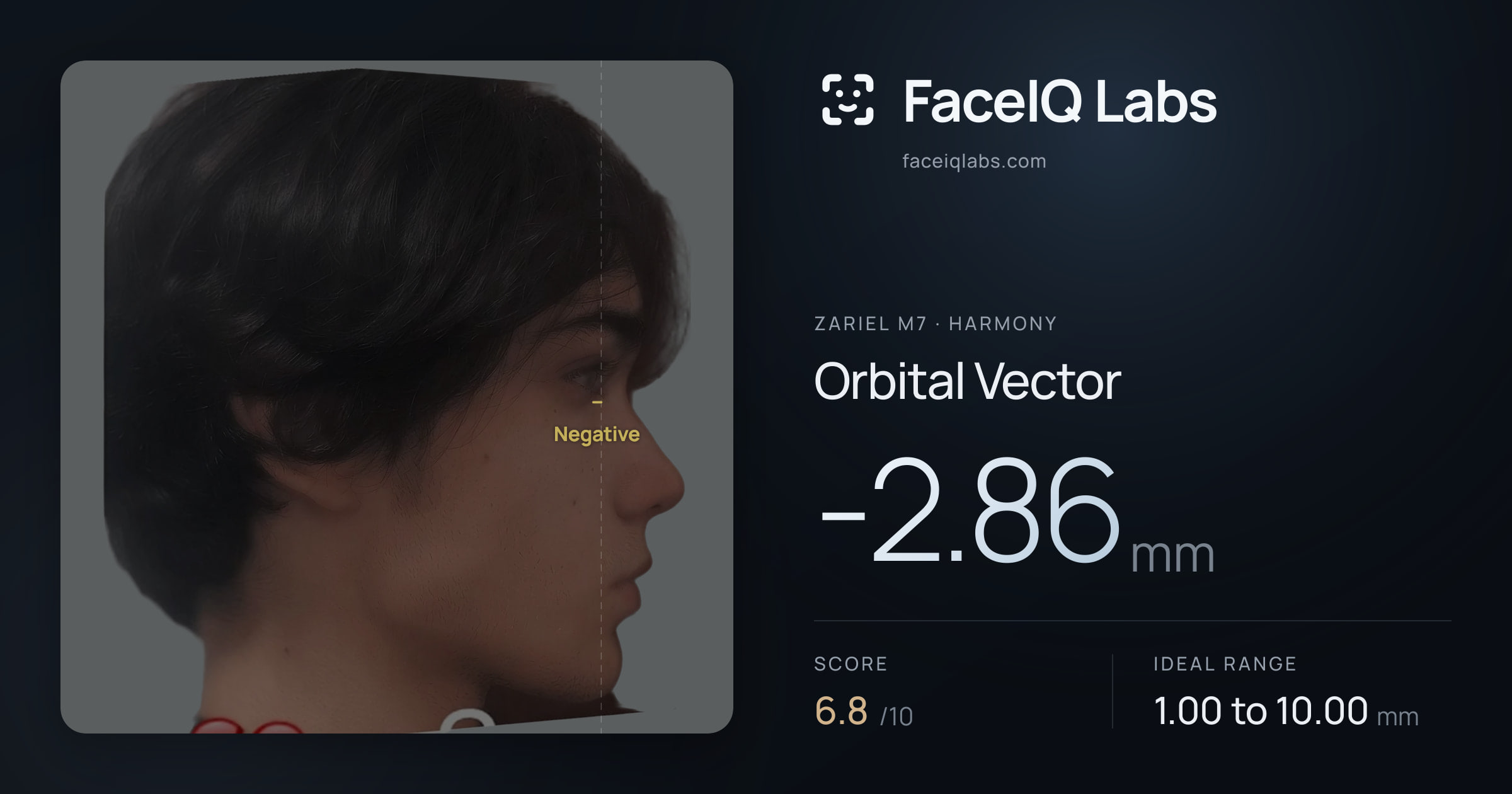 Zariel M7 Orbital Vector: -2.86mm, drawn on the photo