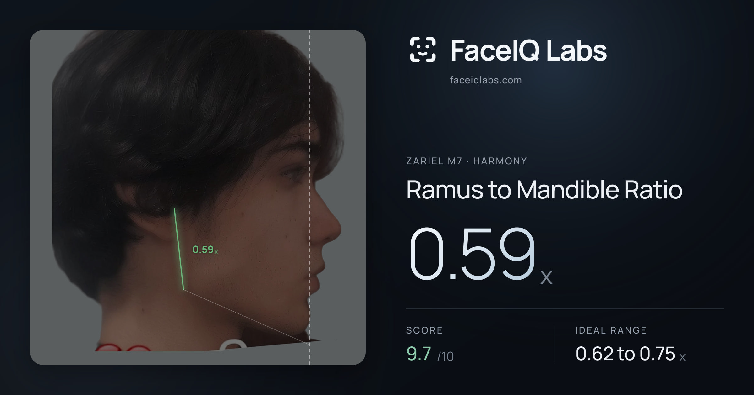 Zariel M7 Ramus to Mandible Ratio: 0.59x, drawn on the photo