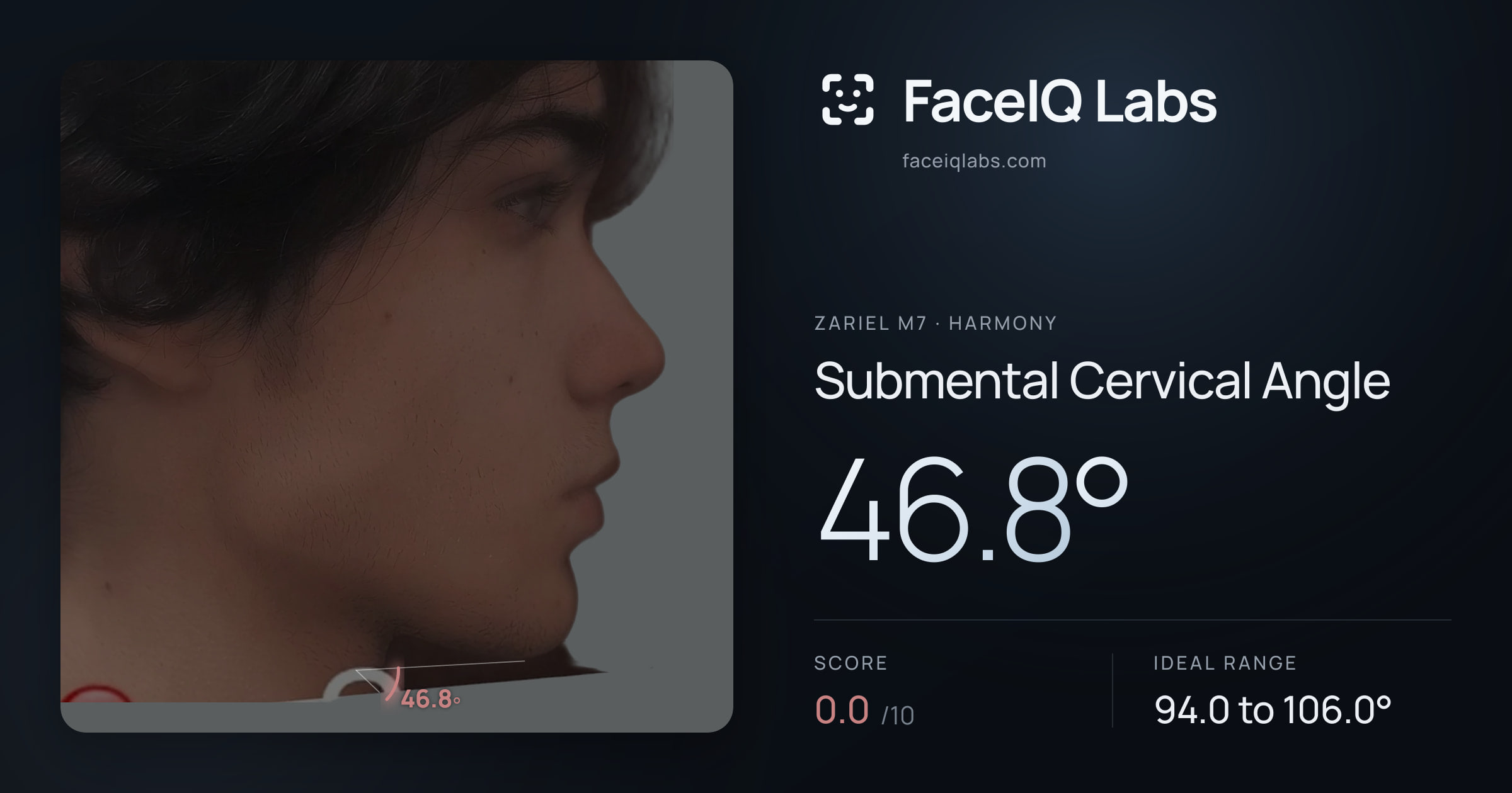 Zariel M7 Submental Cervical Angle: 46.8°, drawn on the photo