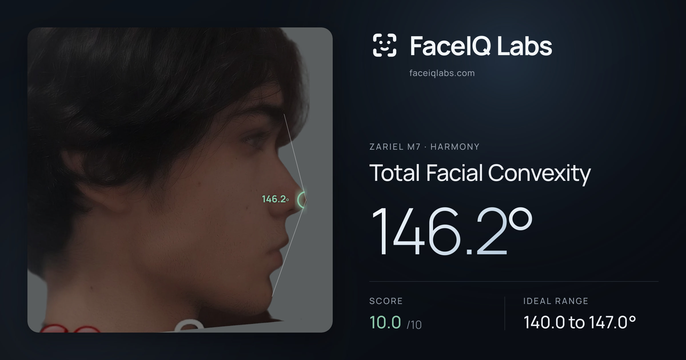 Zariel M7 Total Facial Convexity: 146.2°, drawn on the photo
