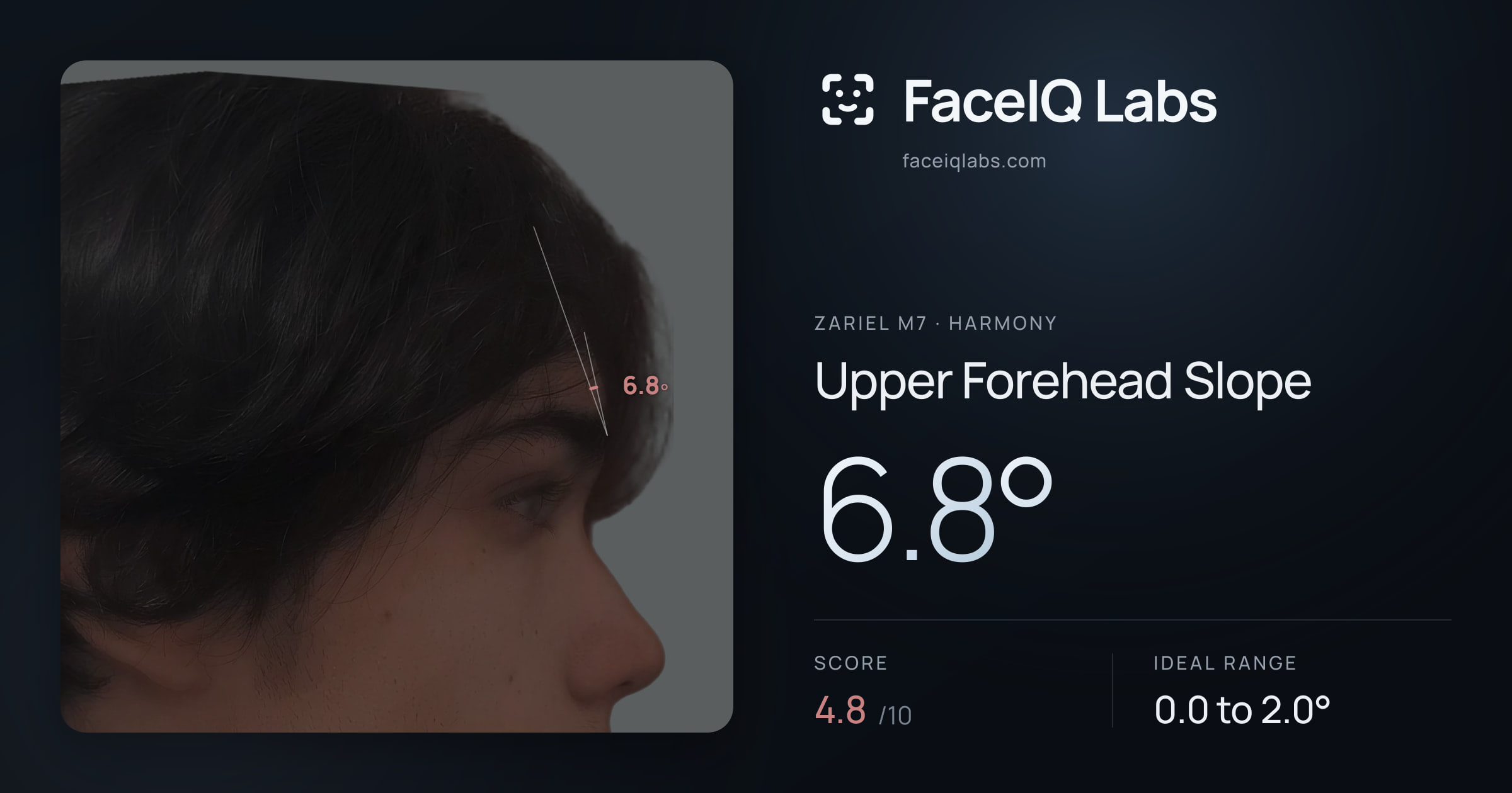 Zariel M7 Upper Forehead Slope: 6.8°, drawn on the photo